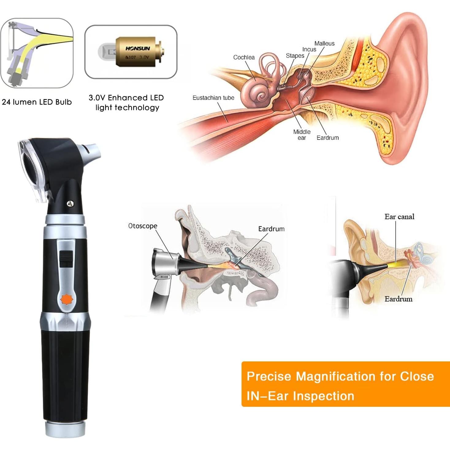 Kit de Otoscopio Jeebel Camp con LED 3X y 4 Puntas