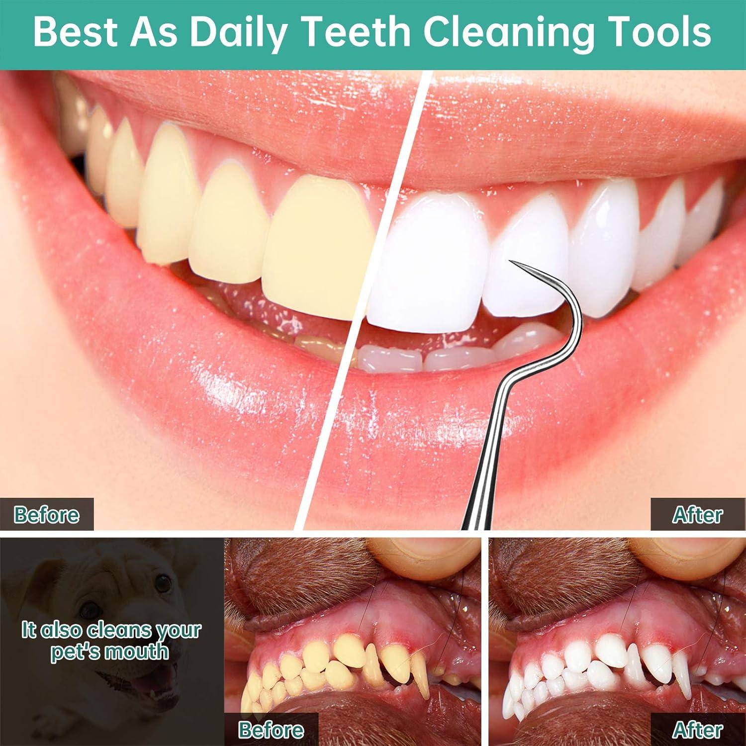 Kit de Herramientas Dentales Profesionales Polkastore - Raspador de Sarro Acero Inoxidable