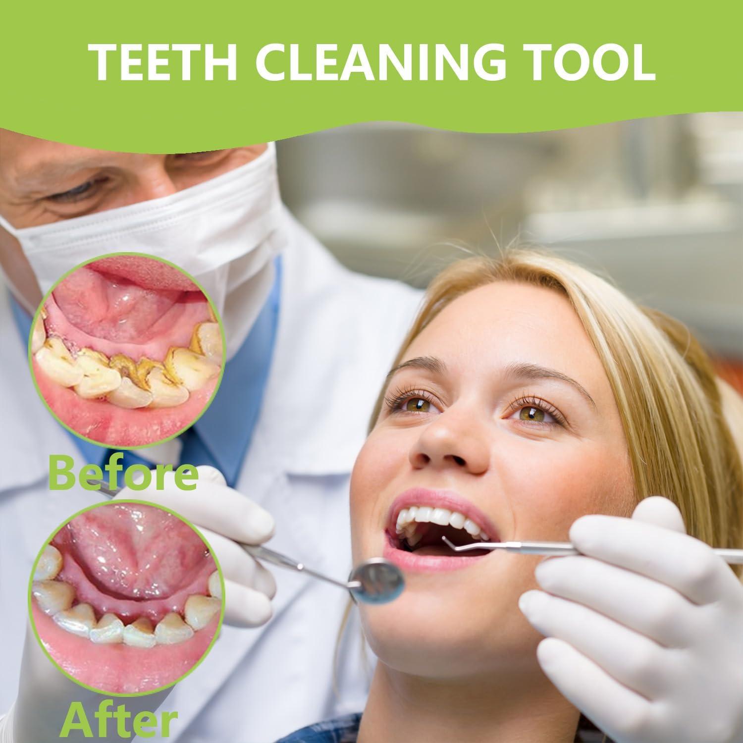 Kit de Higiene Oral Profesional PARYUNGR - Acero Inoxidable