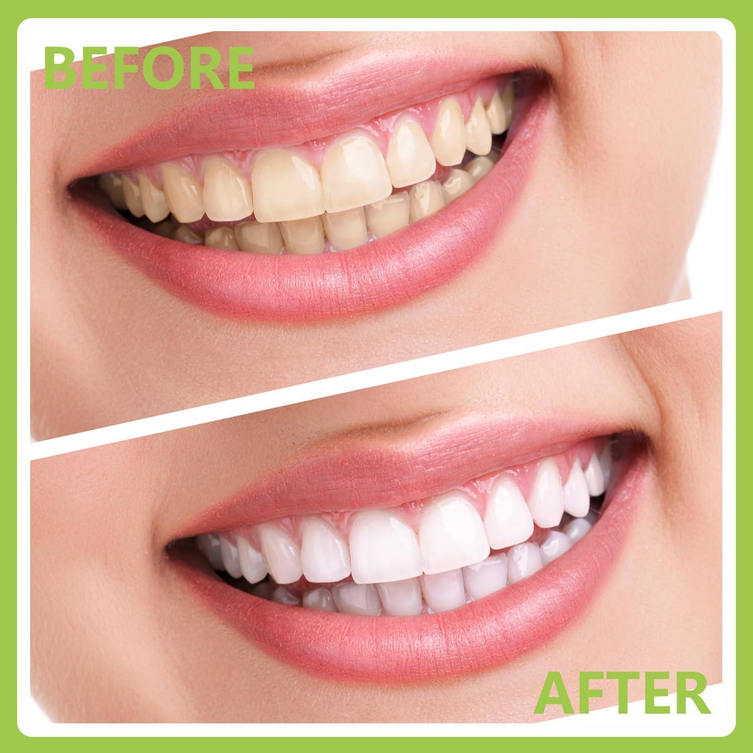 Kit de Higiene Oral Profesional PARYUNGR - Acero Inoxidable