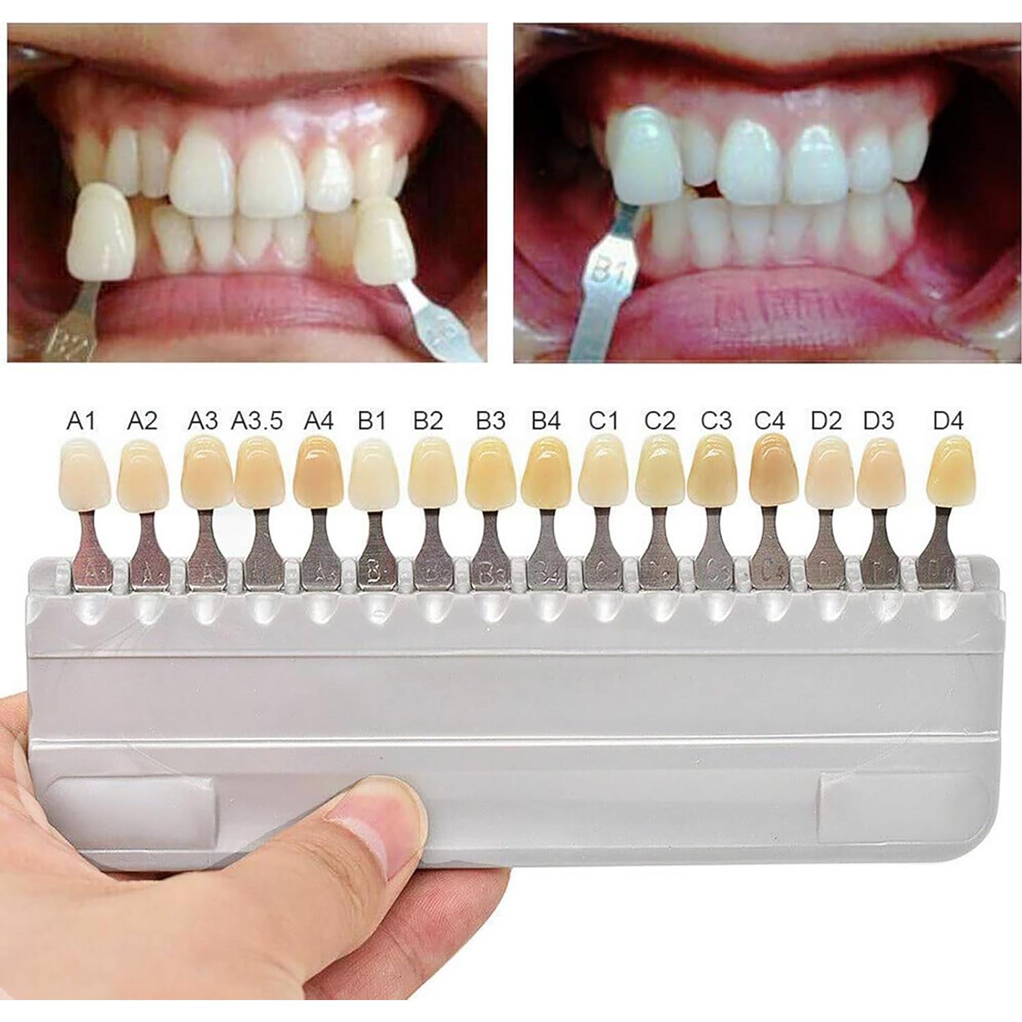 Guía de Sombra Dental Jashem 16 Colores para Blanqueamiento