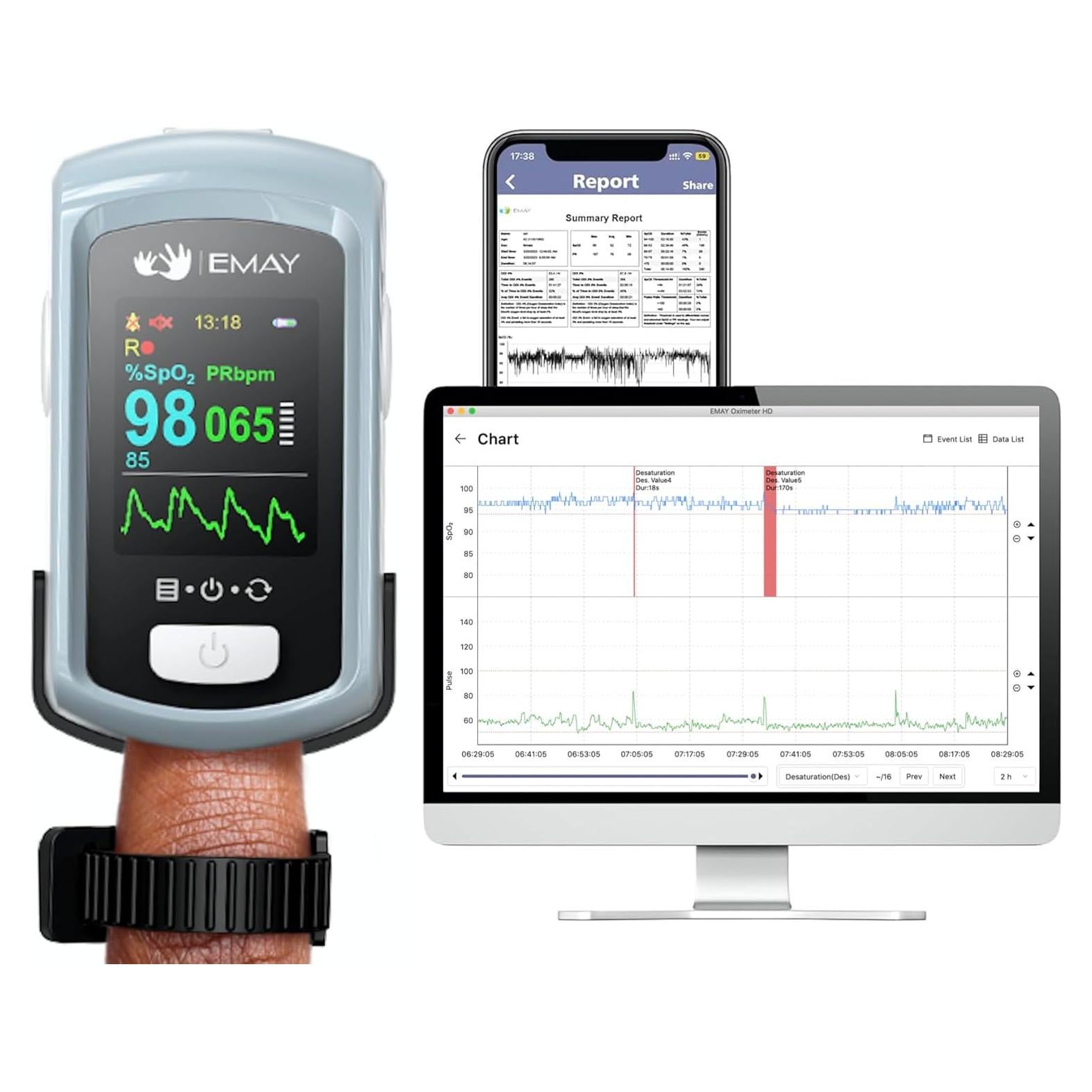 Monitor de Oxígeno EMAY Bluetooth con App y Memoria 72h