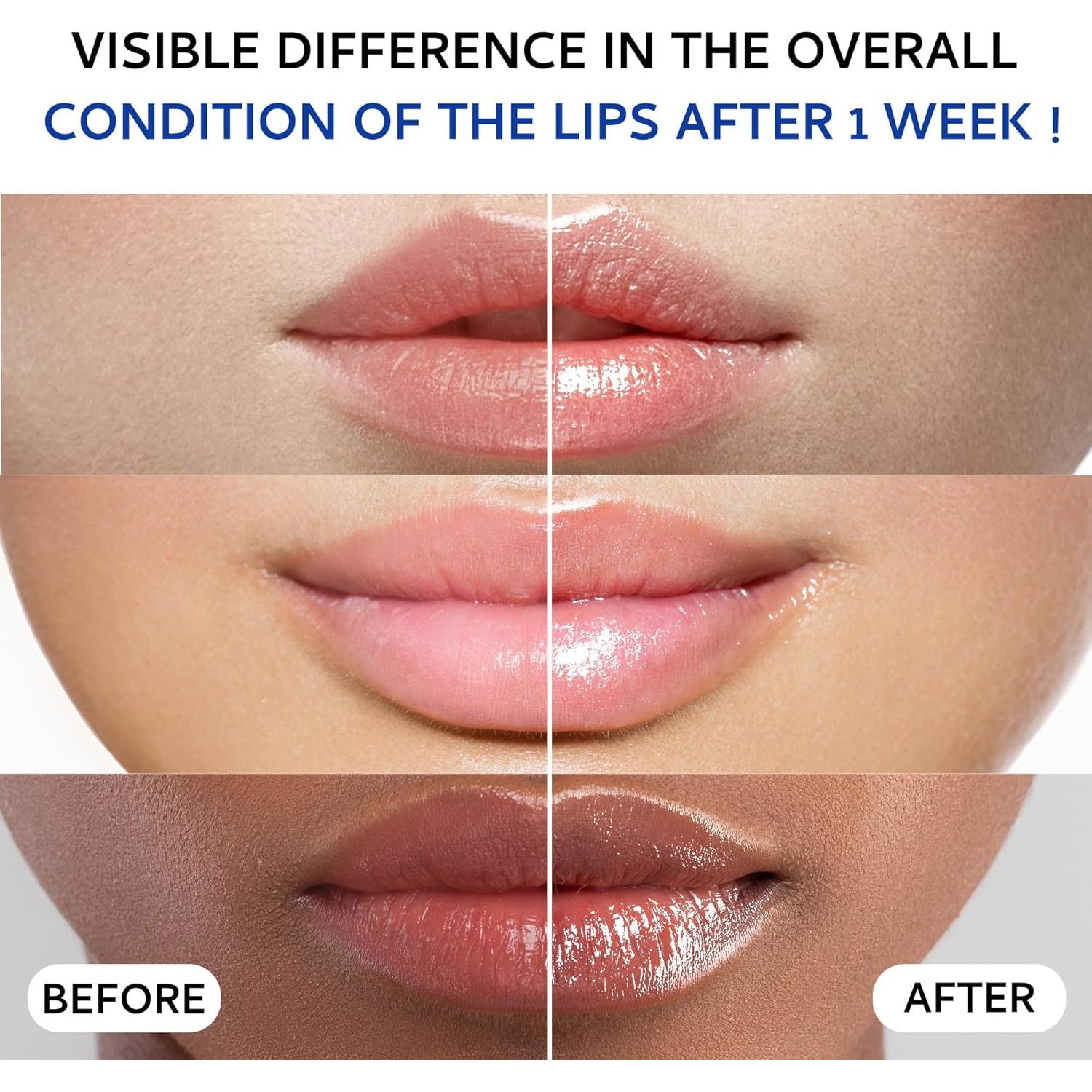 Mascarilla Labial Colágeno 20g - Hidratación y Aumento