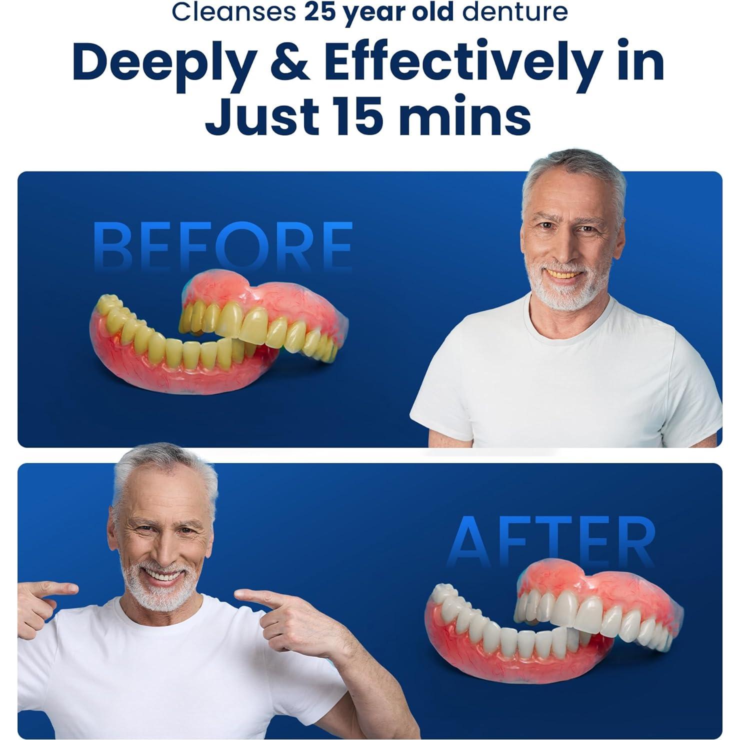 Limpiador Ultrasónico iSonic F3900 para Dentaduras y Retenedores 20W