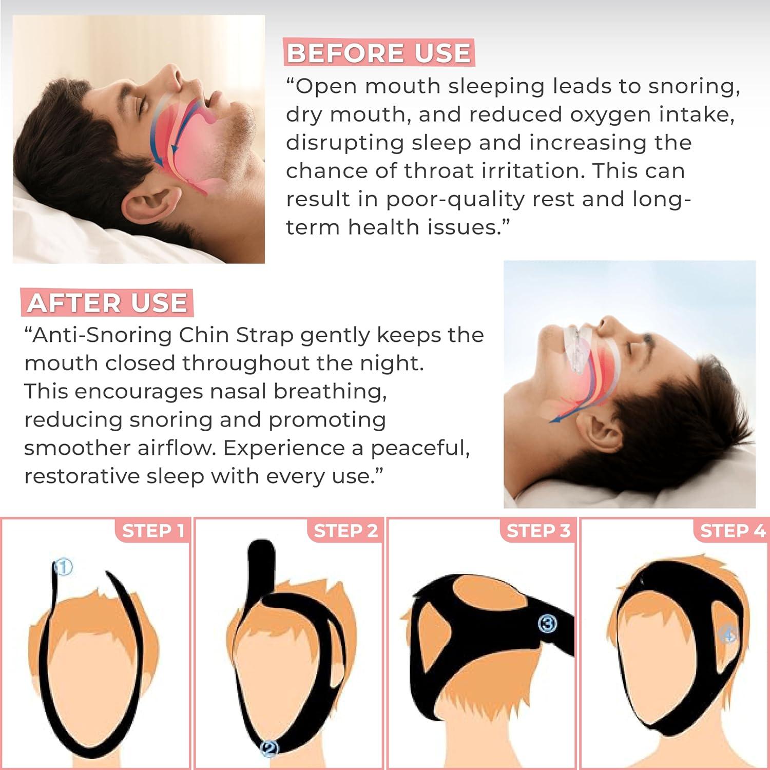 Correa para Barbilla Antironquidos Massner Ajustable Transpirable