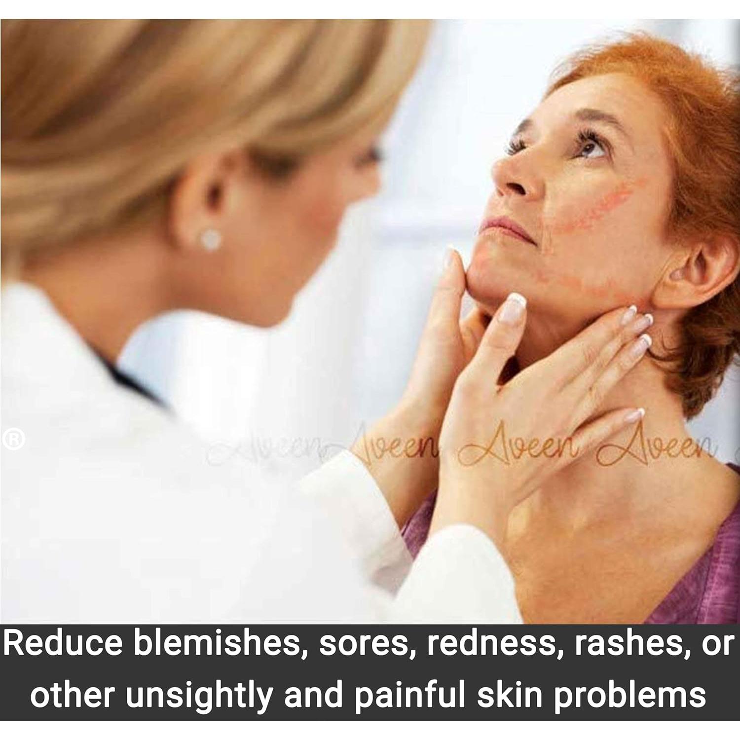 Cubiertas de Correa CPAP Aveen - 4 Paquetes, Suaves y Lavables