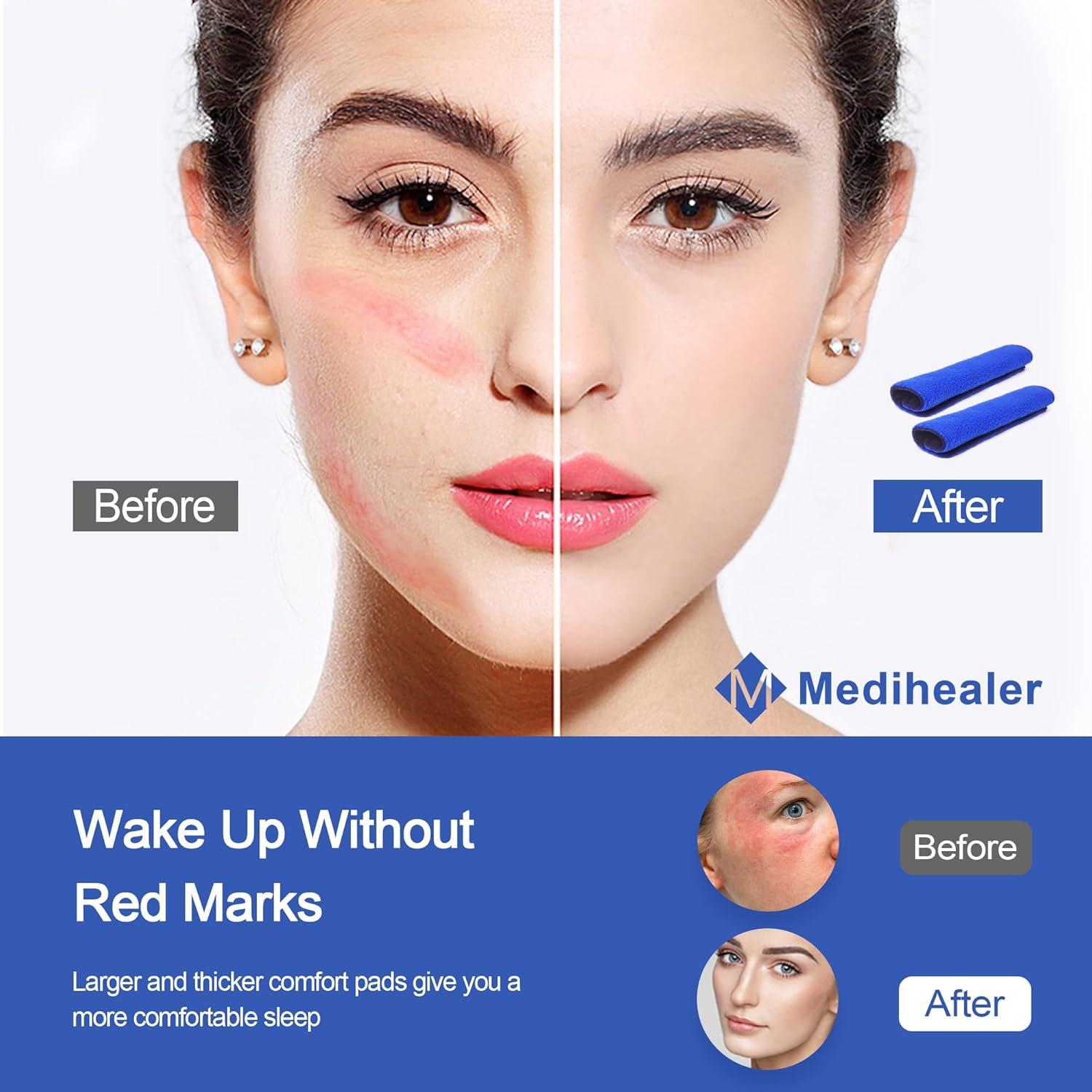 Paquete de 8 fundas para correas de cabeza CPAP Medihealer