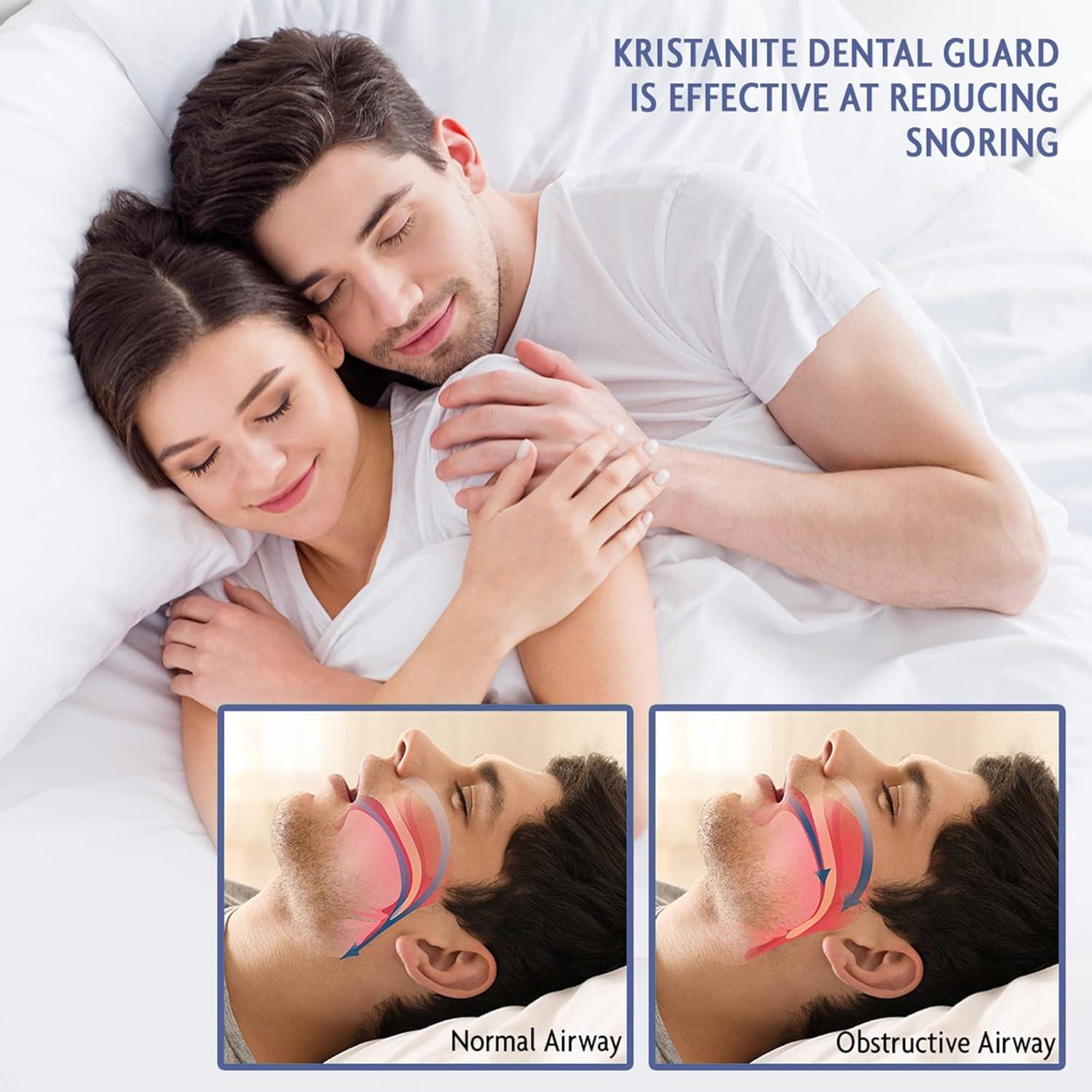Protector Dental Anti Bruxismo SnoreeZ - Listo para Usar