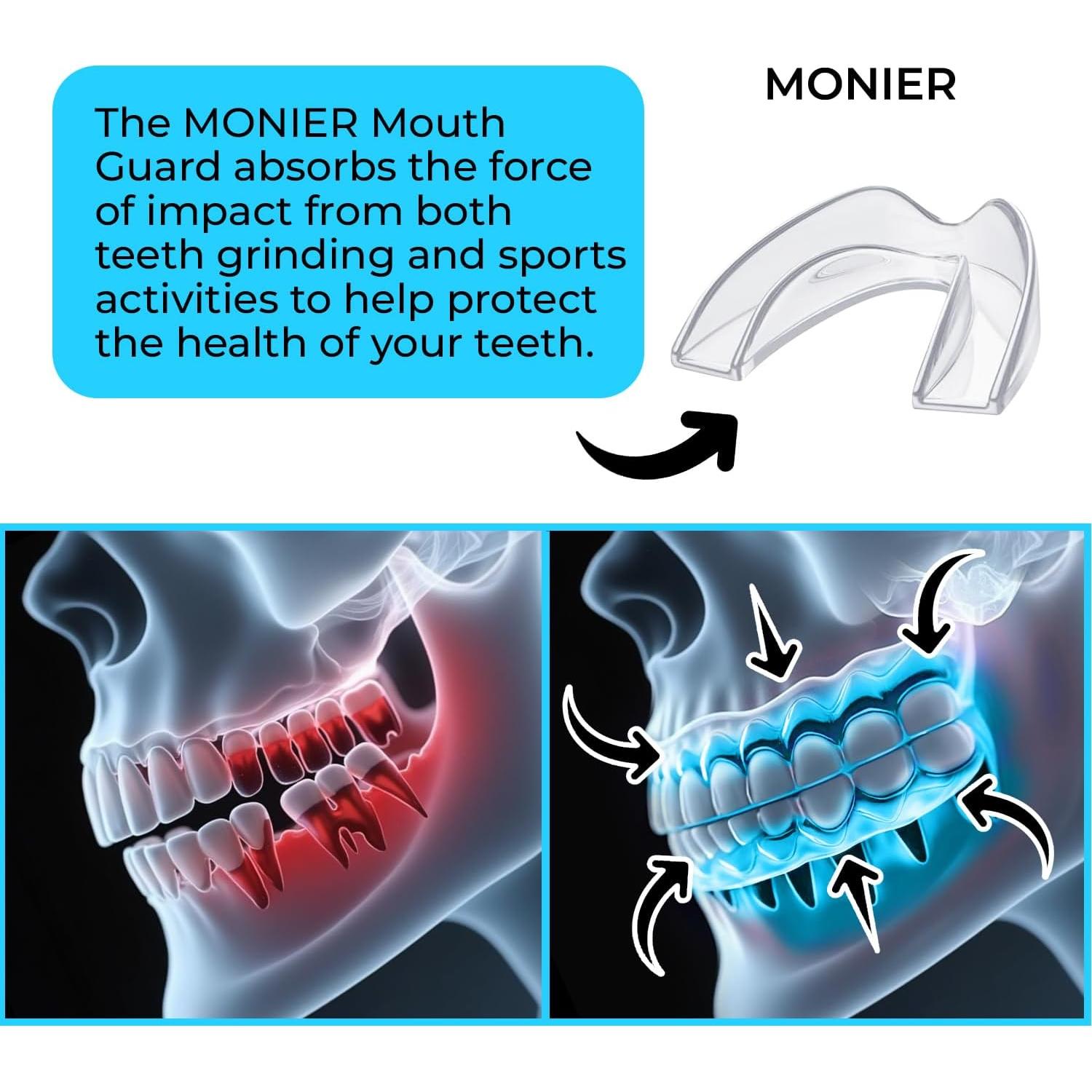 Protector Bucal Nocturno MONIER para Rechinar Dientes - 4 Unidades
