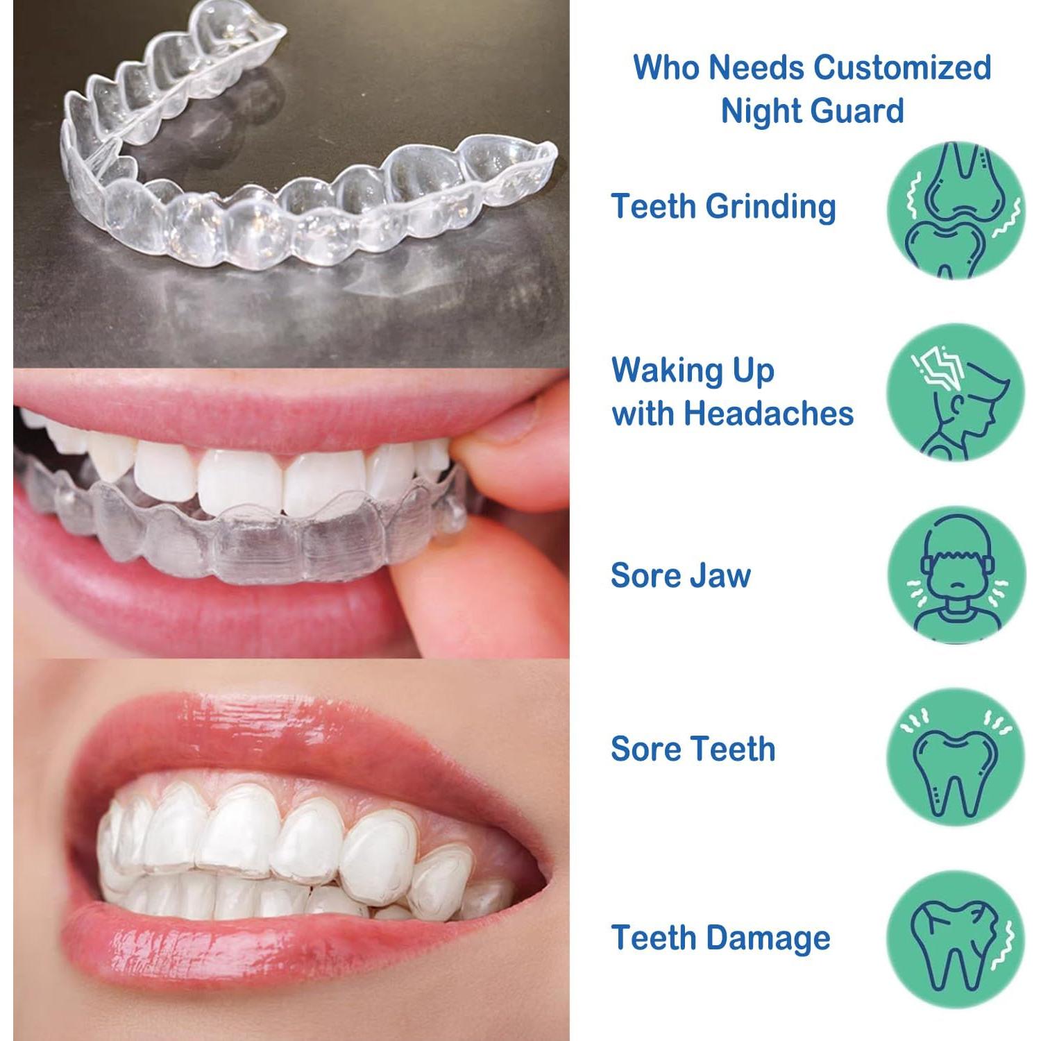 Férula Nocturna Personalizada NORZERO para Bruxismo - 1mm