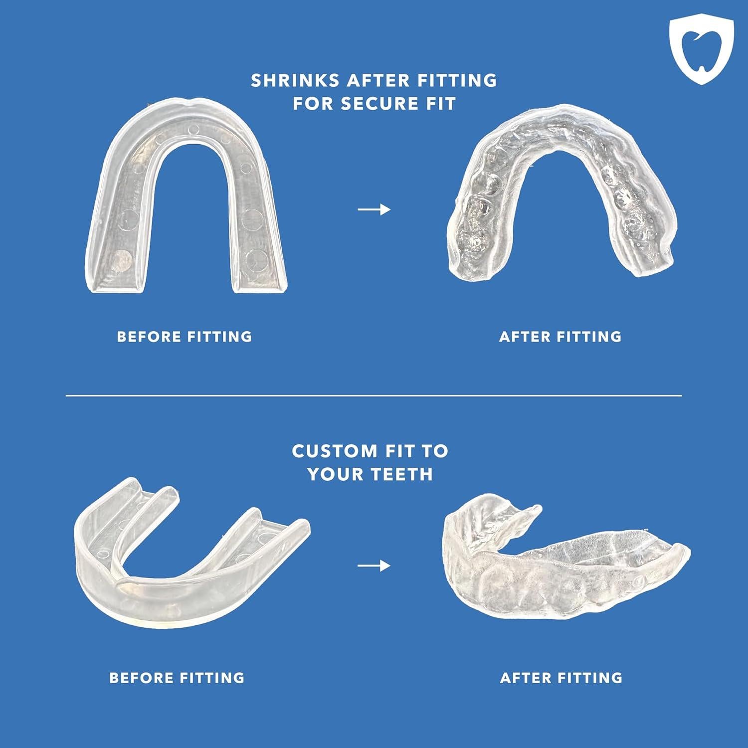 Protector Nocturno Zero Grind GAME ON para Bruxismo
