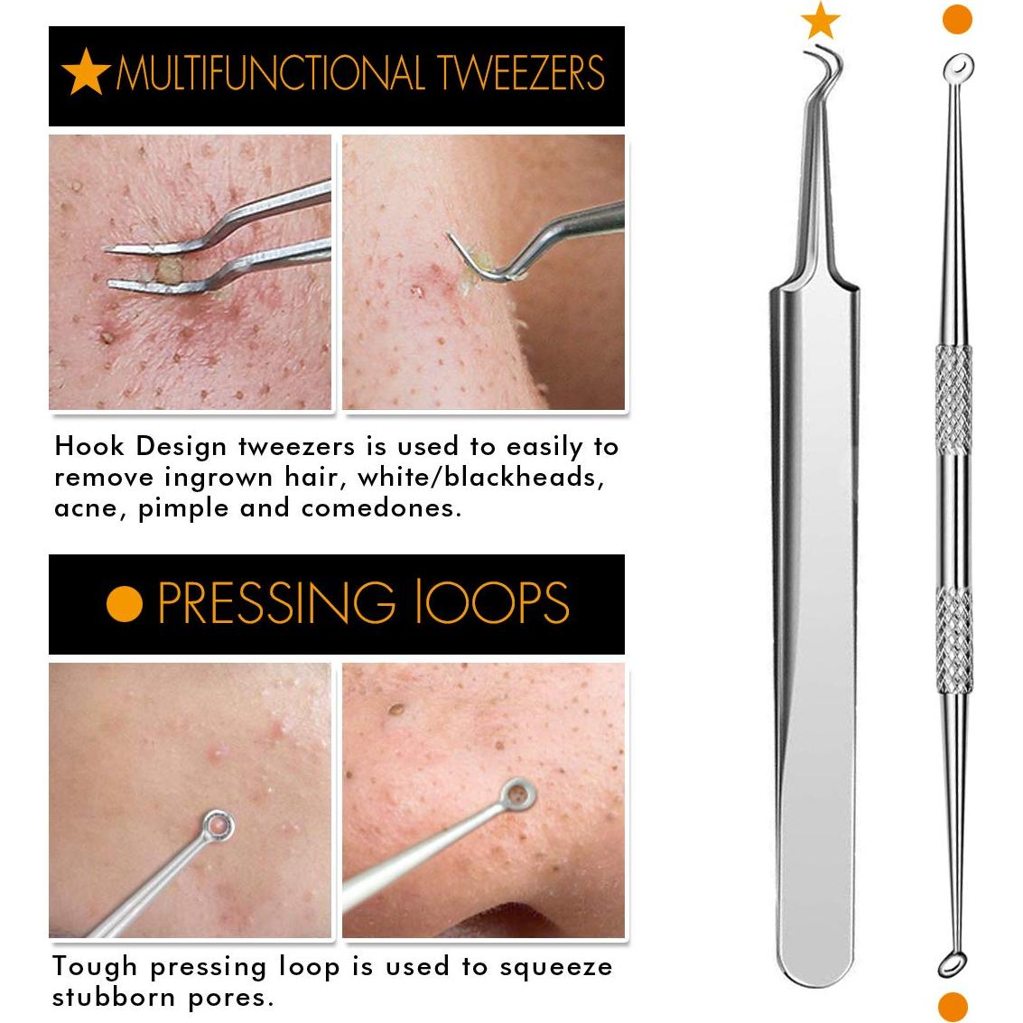 Kit Removedor Puntos Negros 7 Piezas TailaiMei Acero Inox