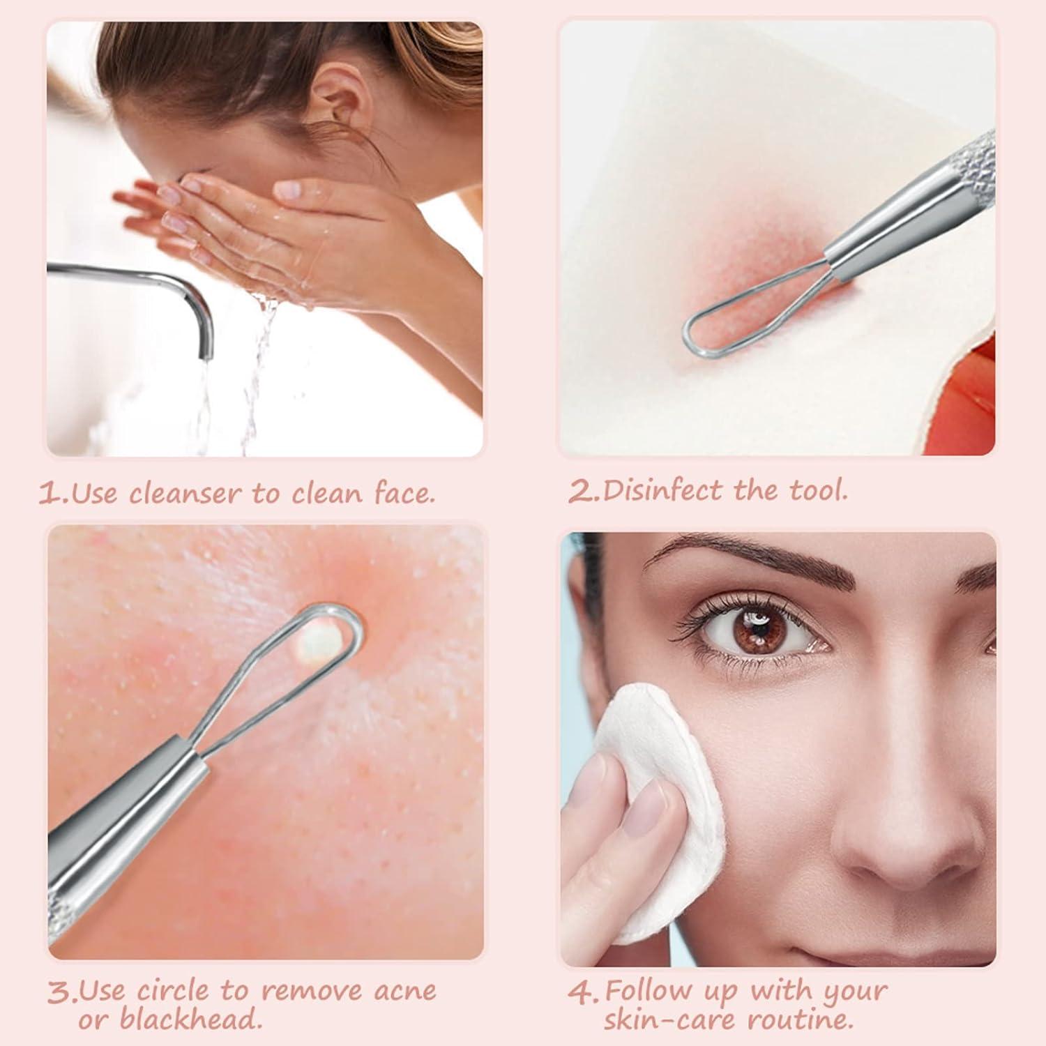 Herramienta Extractora de Imperfecciones Jaxiria 2 Piezas