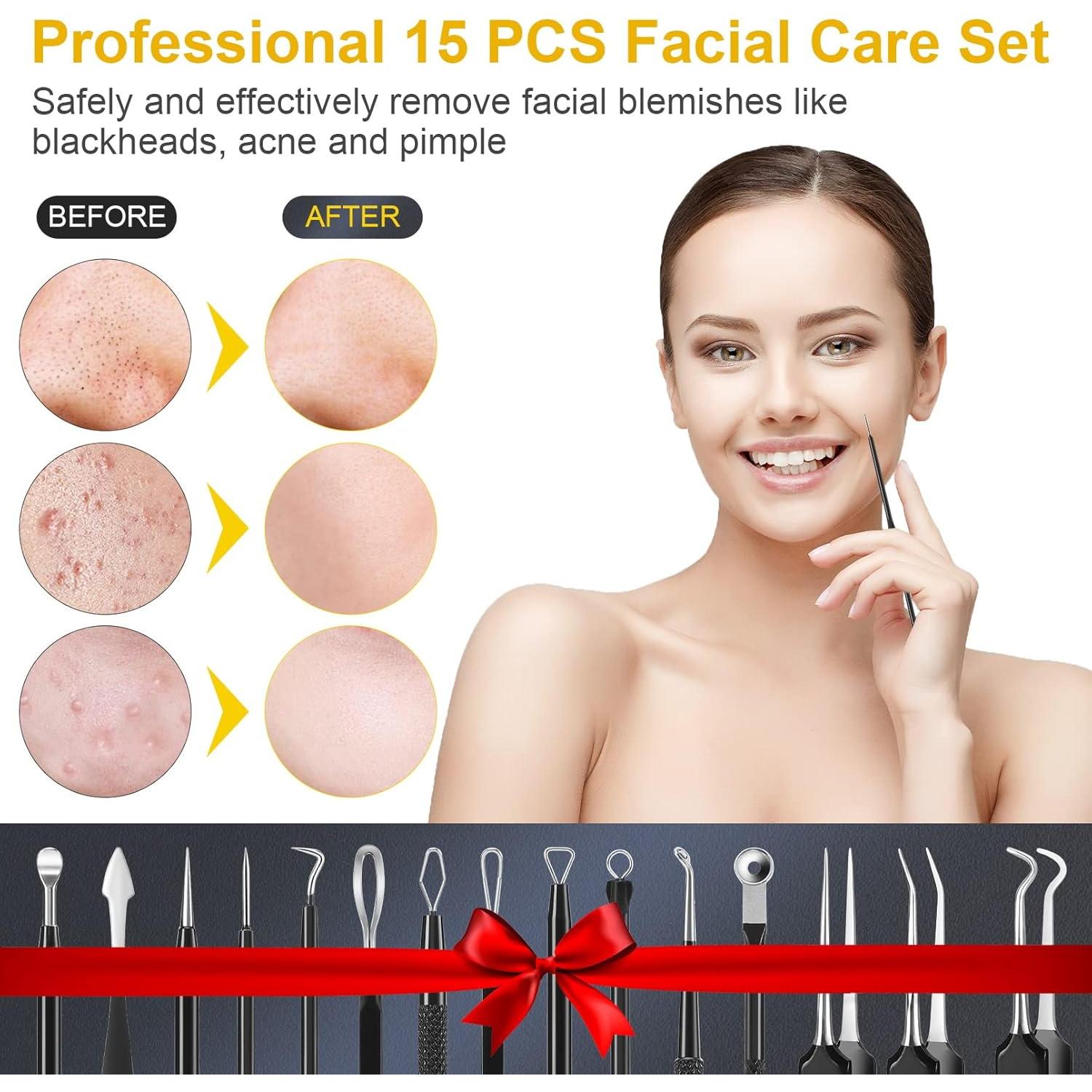 Kit de Herramientas IUMAKEVP 15 PCS Acero Inoxidable para Acné