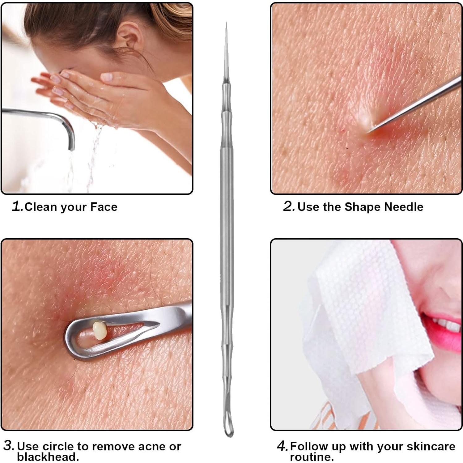 Extractor de Puntos Negros MUZEFAZHAN Acero Inoxidable 2 en 1