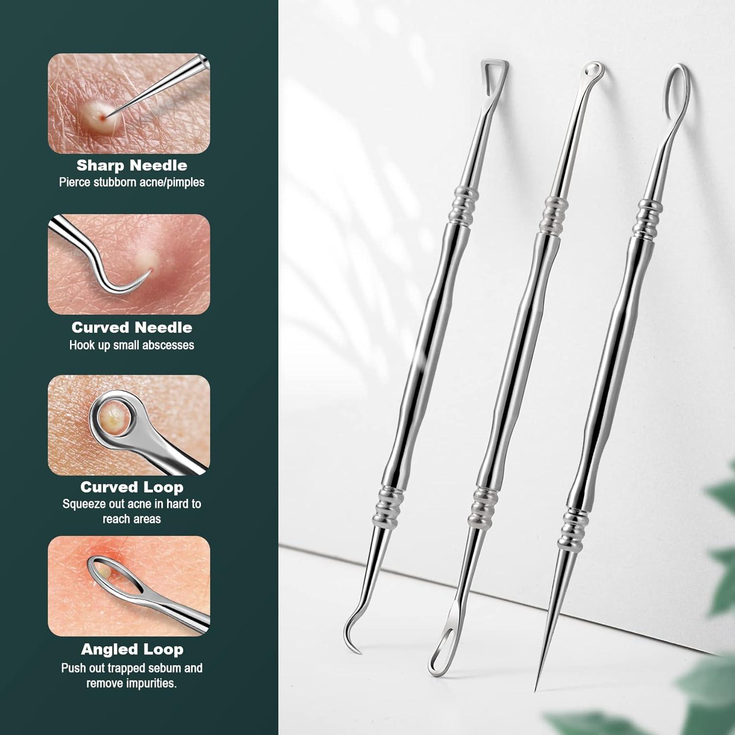 Kit Extractor de Puntos Negros FVION 6 Piezas Acero Inoxidable