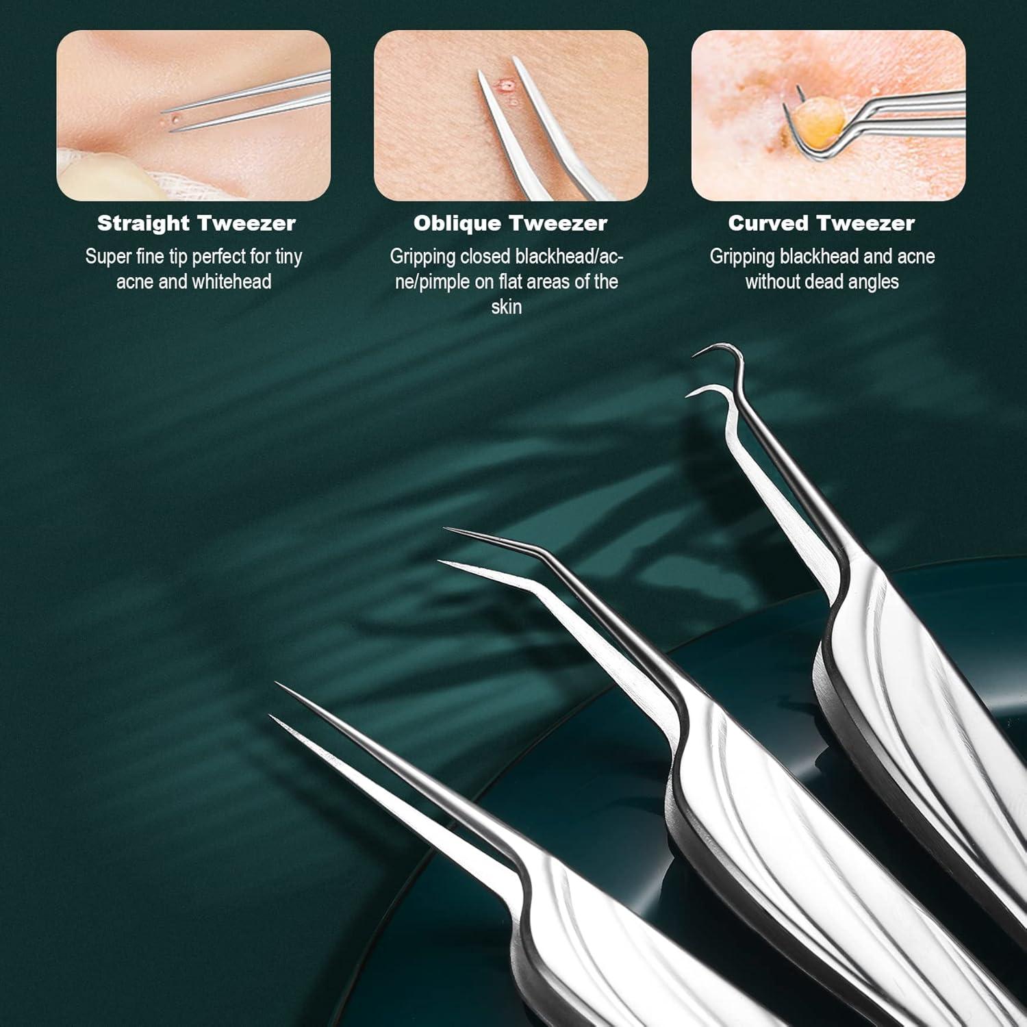 Kit Extractor de Puntos Negros FVION 6 Piezas Acero Inoxidable