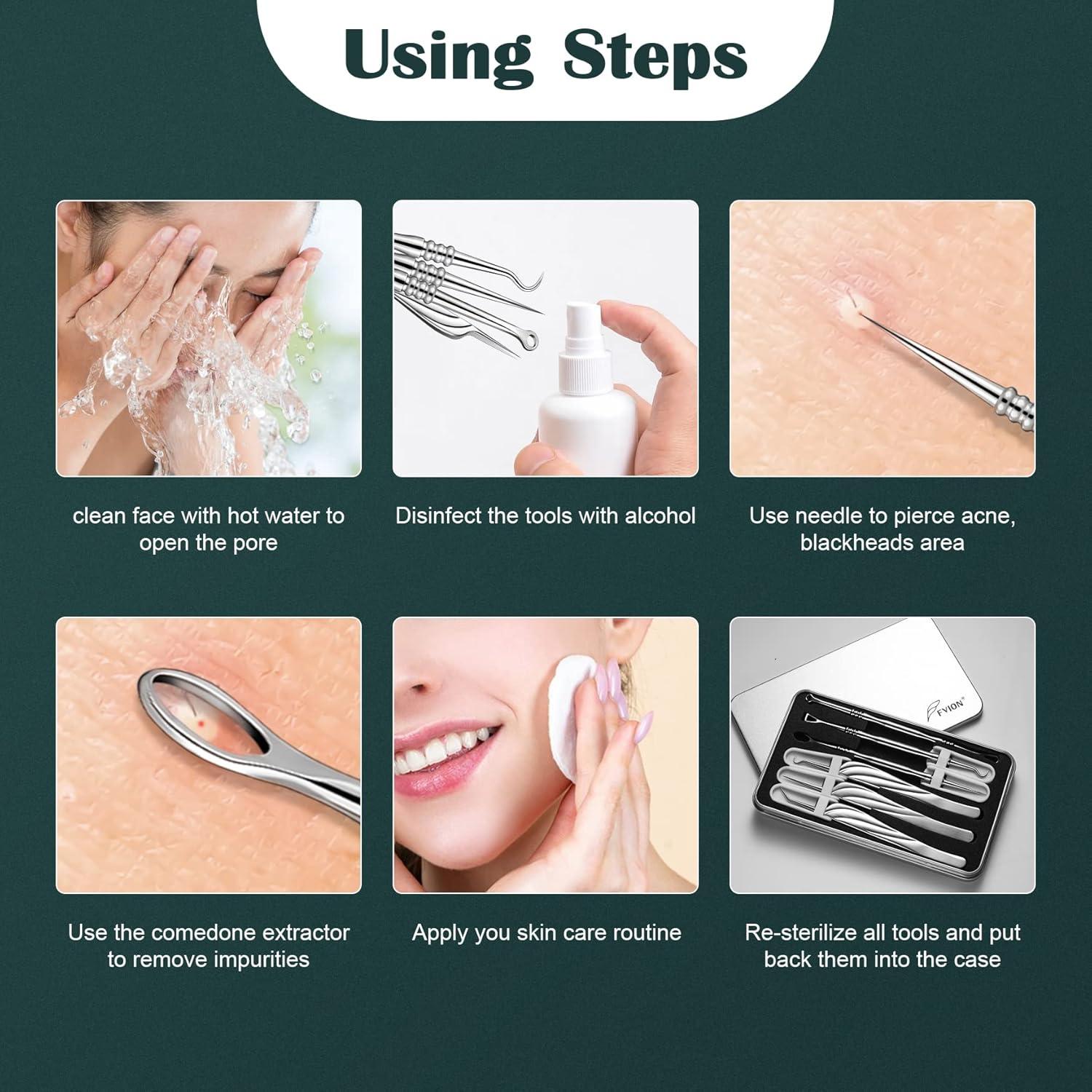 Kit Extractor de Puntos Negros FVION 6 Piezas Acero Inoxidable