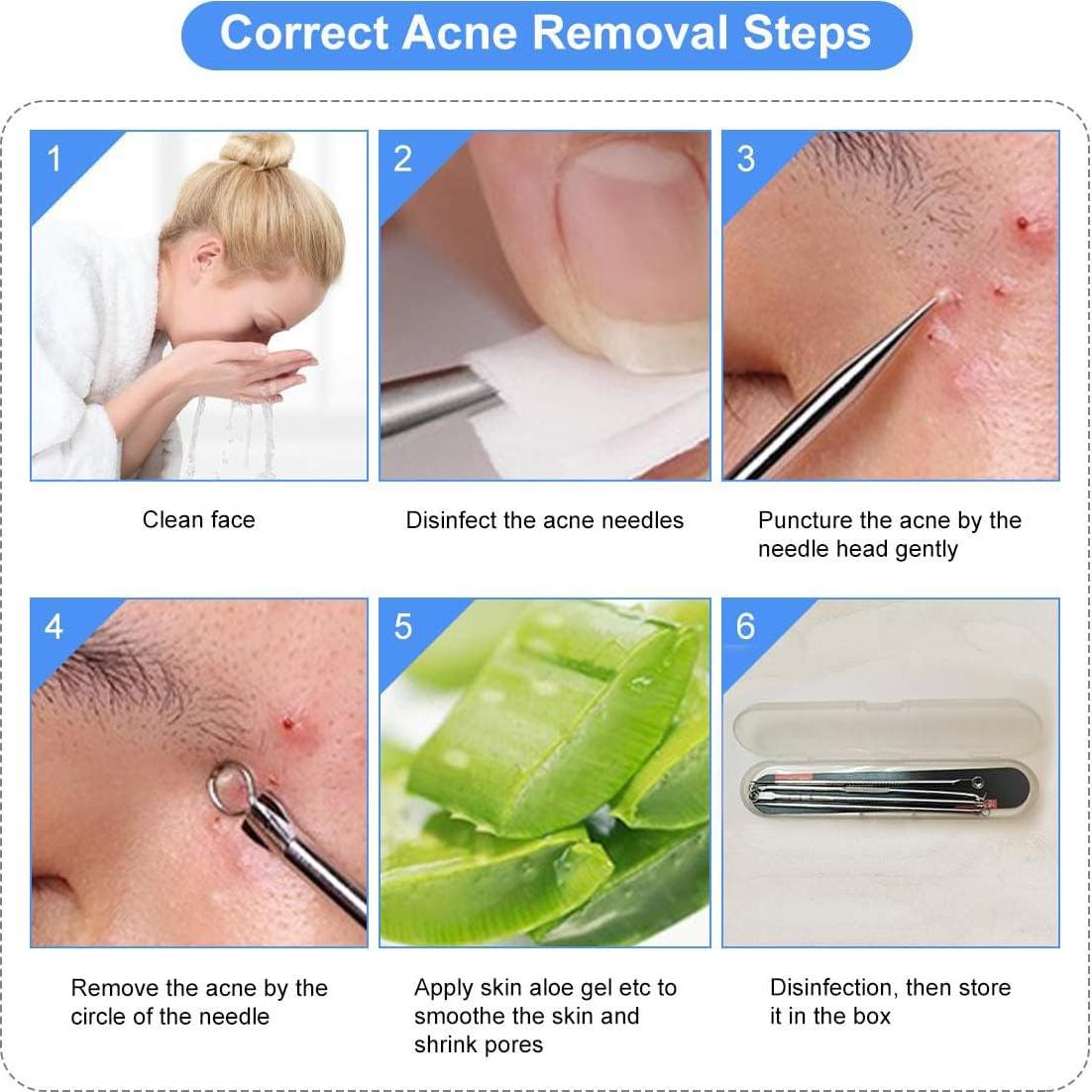 Kit de Herramientas de Extracción de Espinillas HaimiLiya 4 Piezas