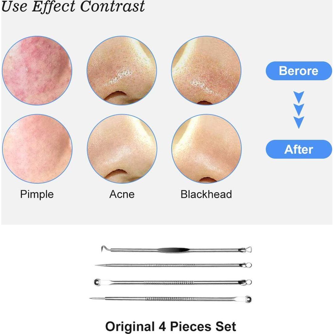 Kit de Herramientas de Extracción de Espinillas HaimiLiya 4 Piezas