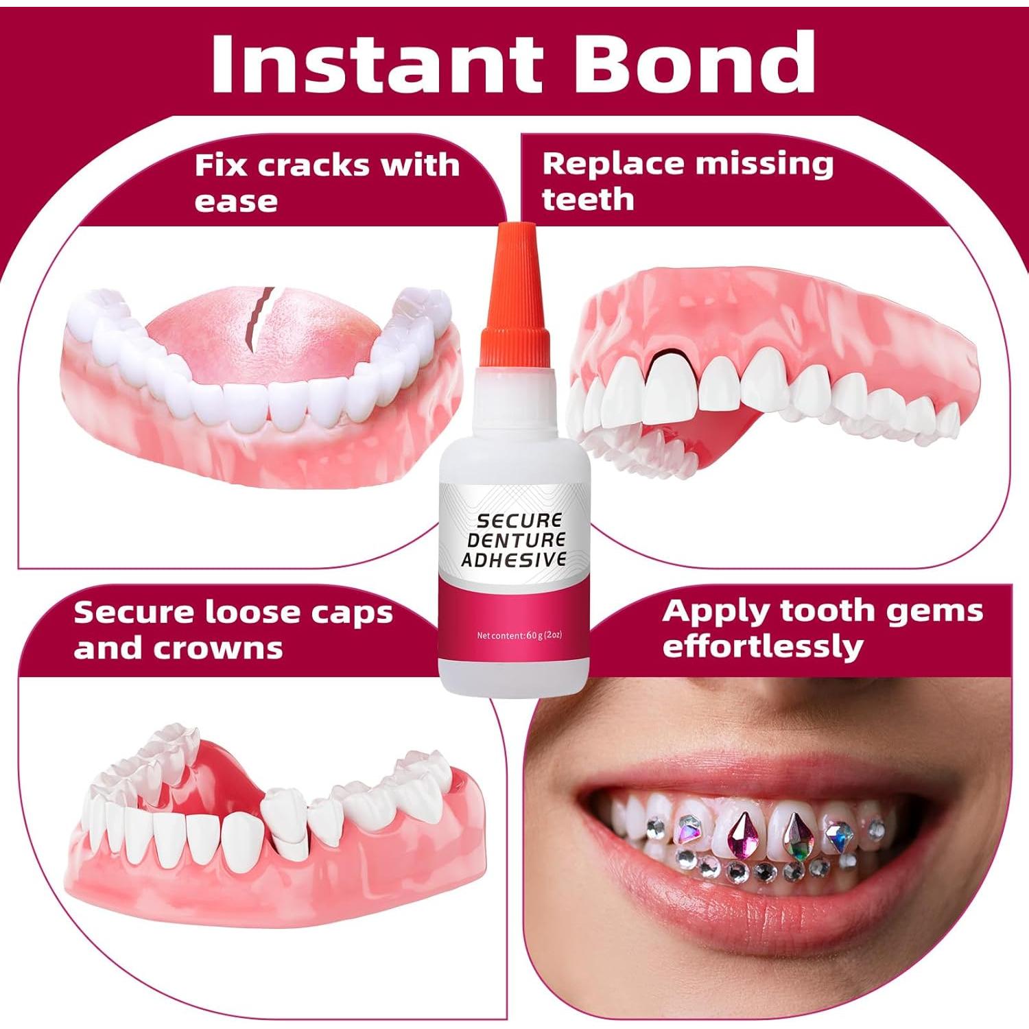 Pegamento Dental Instantáneo Liovsiso 60ml Adhesivo Rápido
