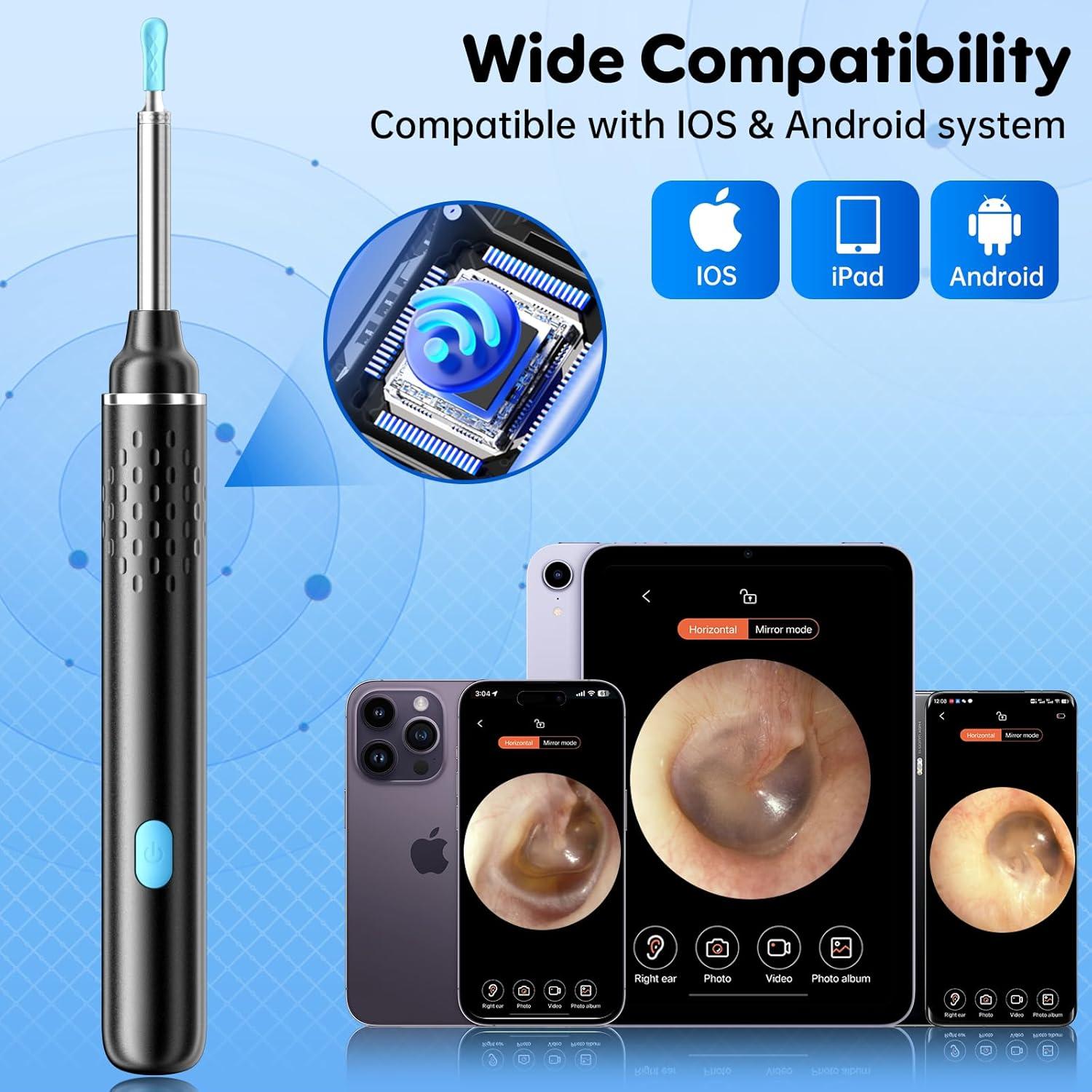 Limpiador de Oído COONYES con Cámara 1080P HD y 8 Puntas