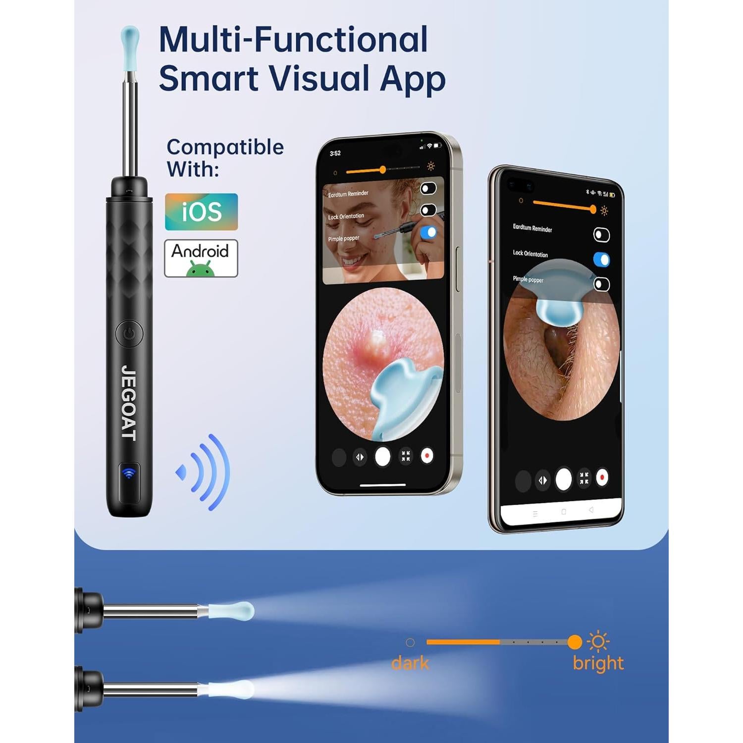 Kit de Eliminación de Cerumen Jegoat S9 con Cámara 1296P HD