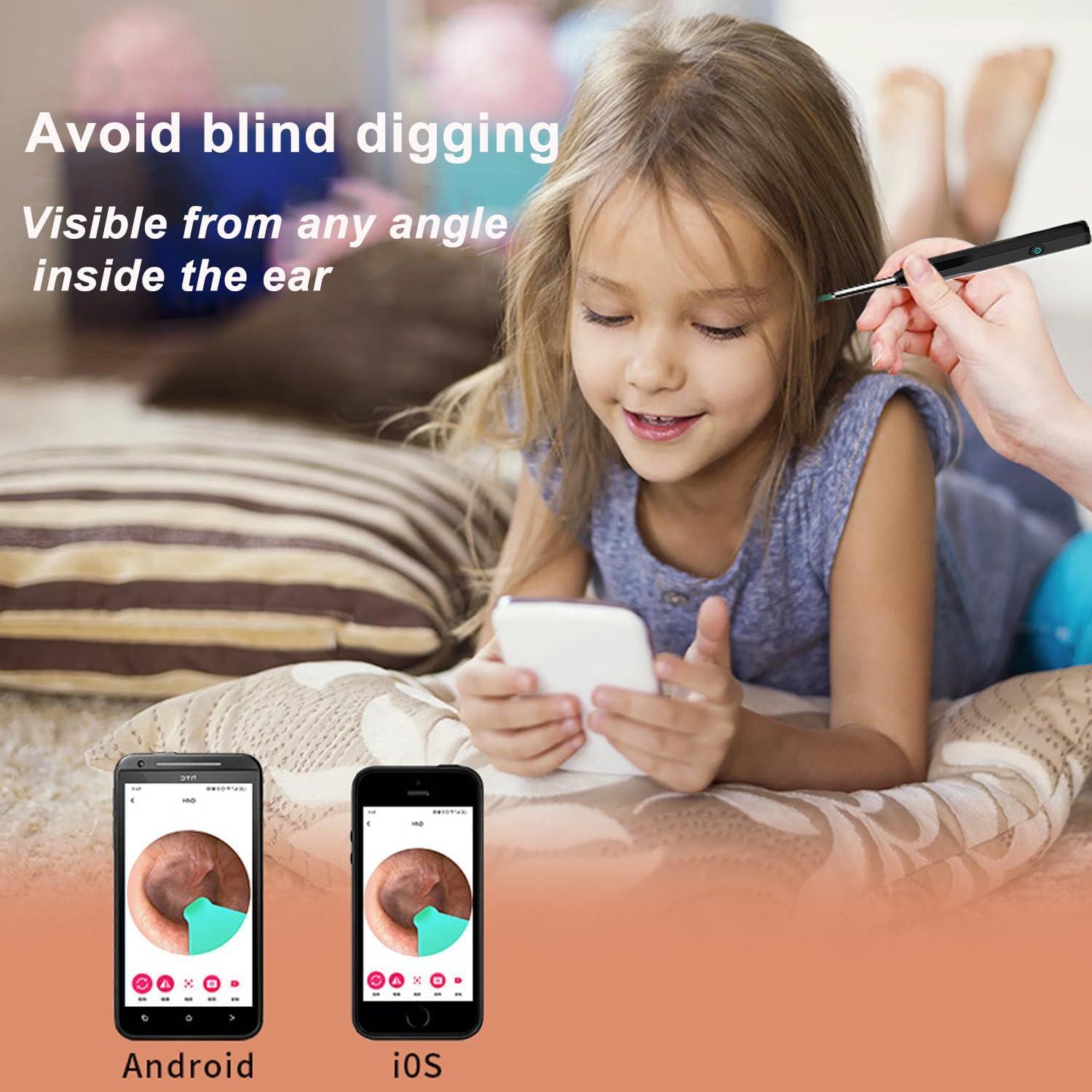 Limpiador de Oído con Cámara 1080P OKUBOX y 6 Luces LED