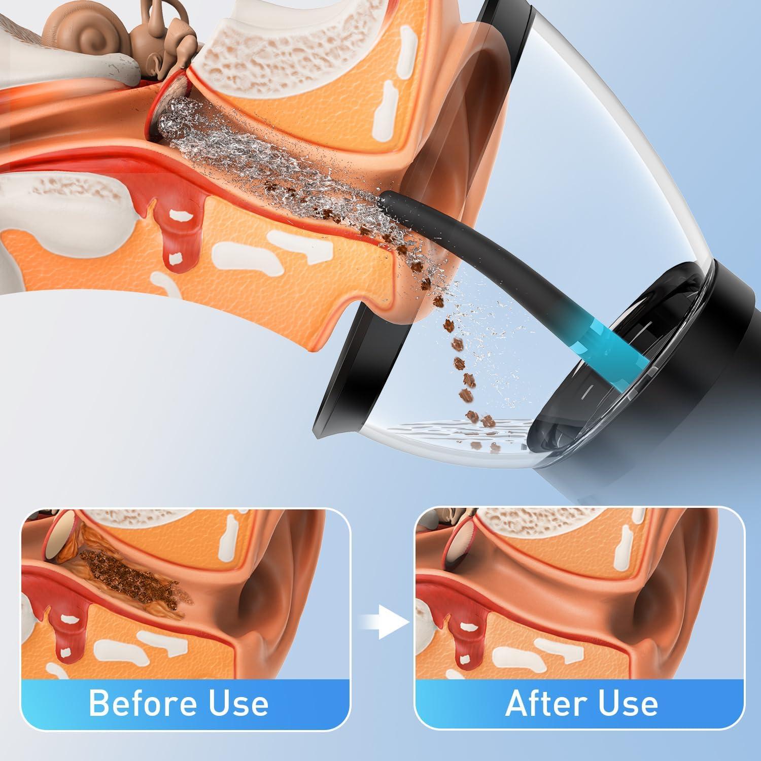 Limpiador de Cera de Oído Eléctrico HeaDot IPX6 4 Modos