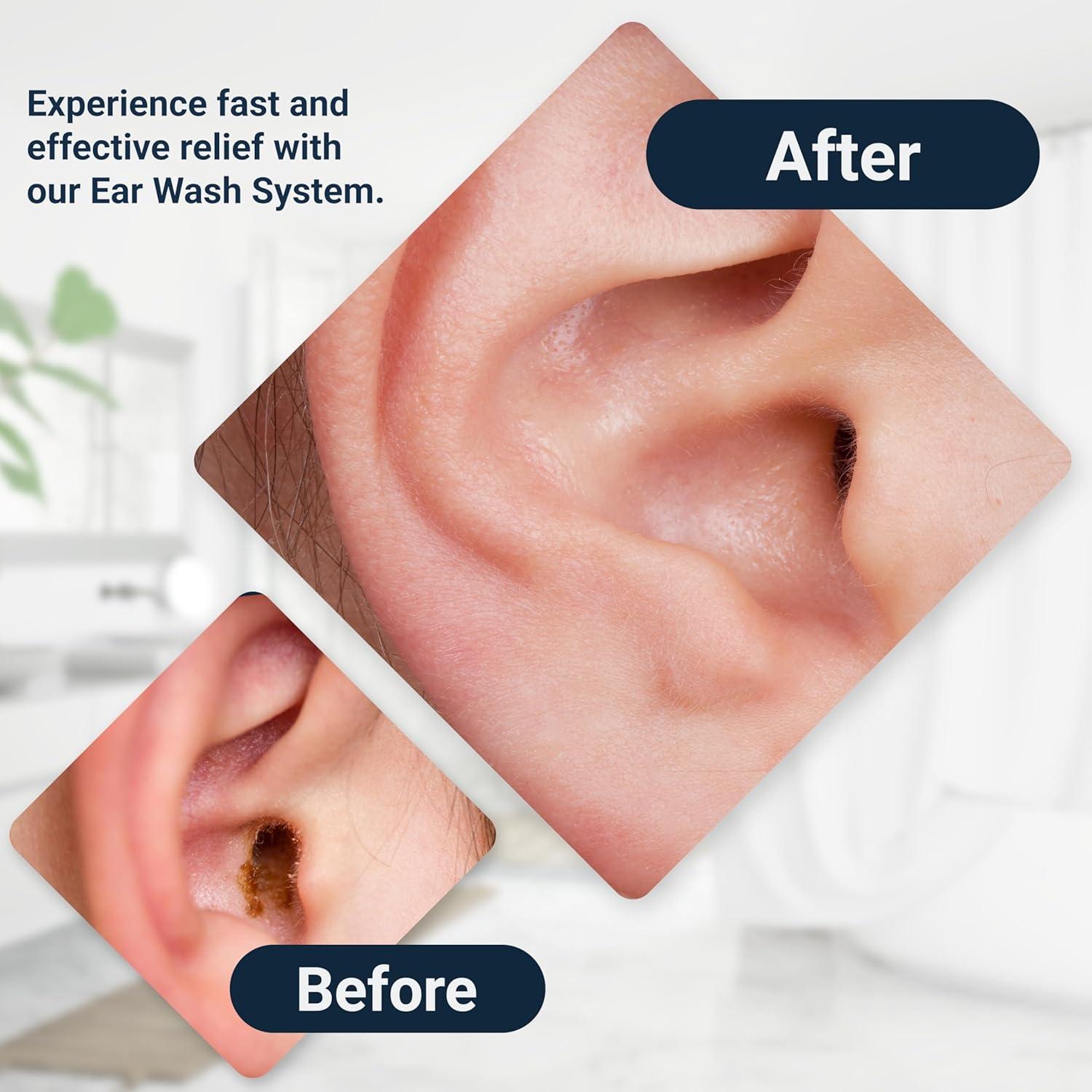 Sistema de lavado de oídos Wax-Rx Doctor Easy 450 ml