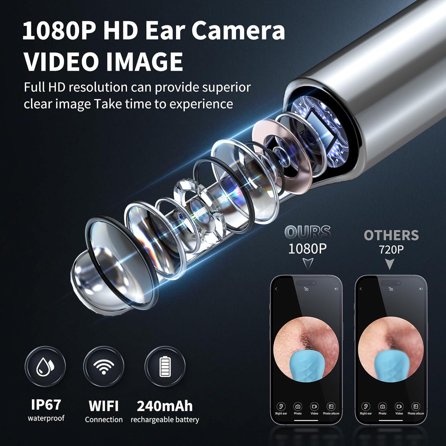 Limpiador de Oídos LENGIN X6 con Cámara 1080P y 6 Cucharas