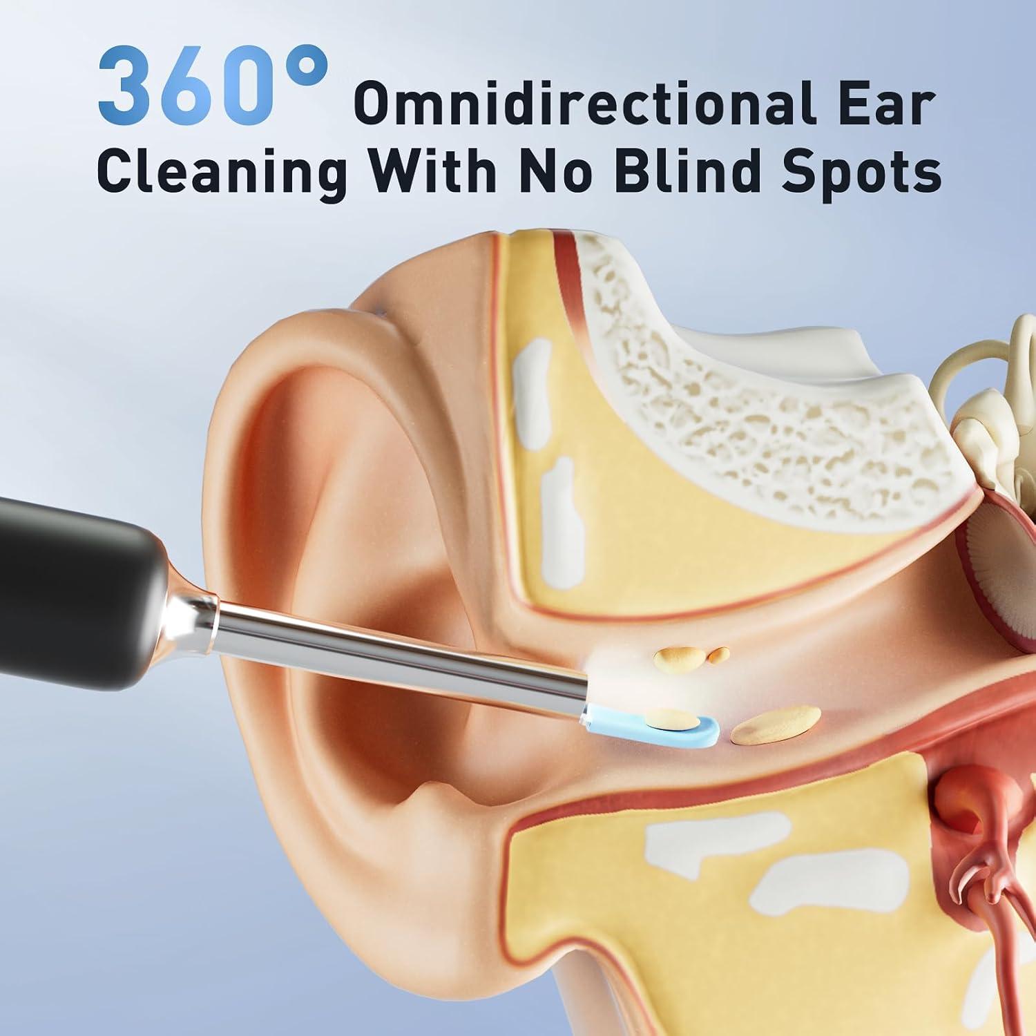 Sistema de Limpieza de Oídos Eléctrico Lebbtl W60-N con Cámara 1080P