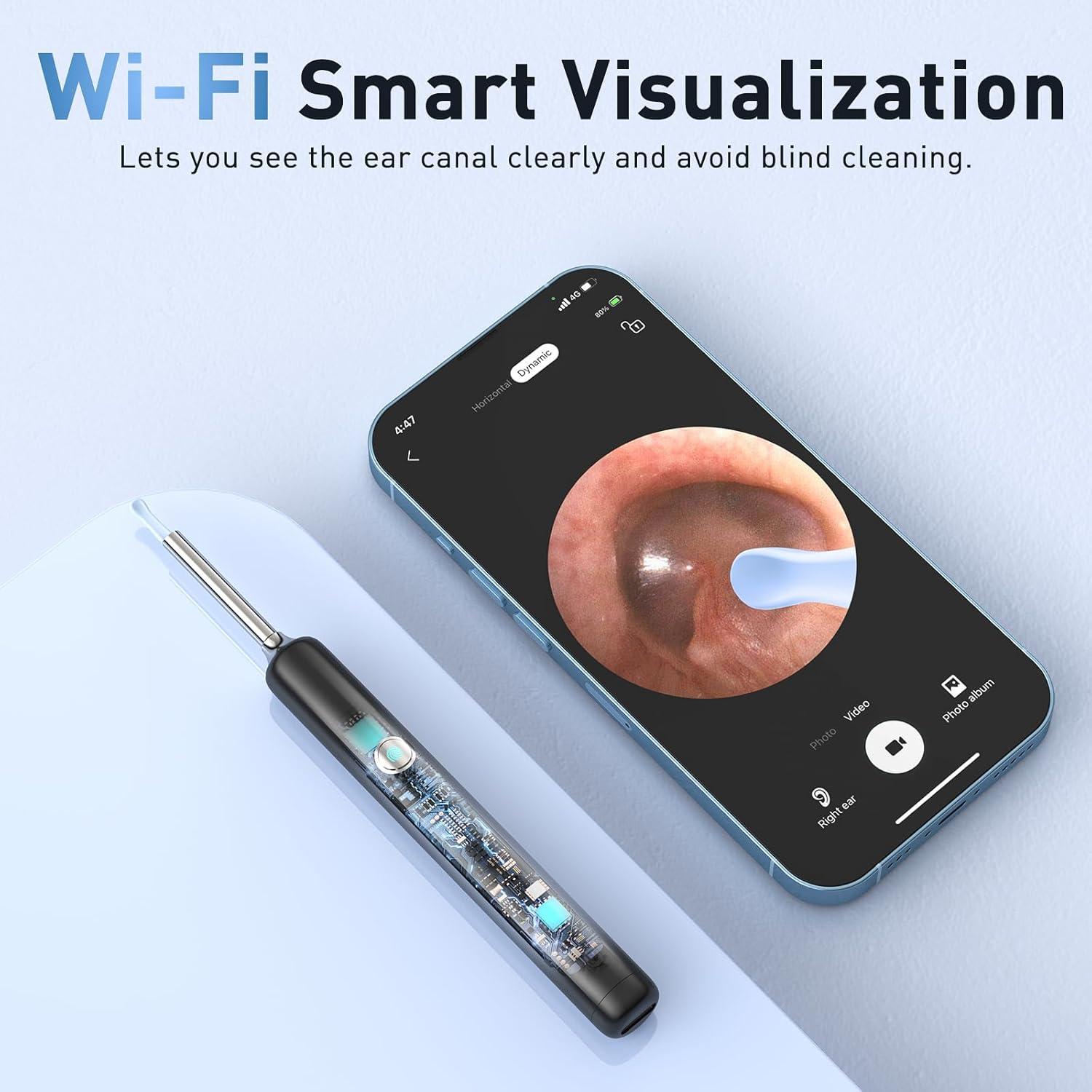 Sistema de Limpieza de Oídos Eléctrico Lebbtl W60-N con Cámara 1080P