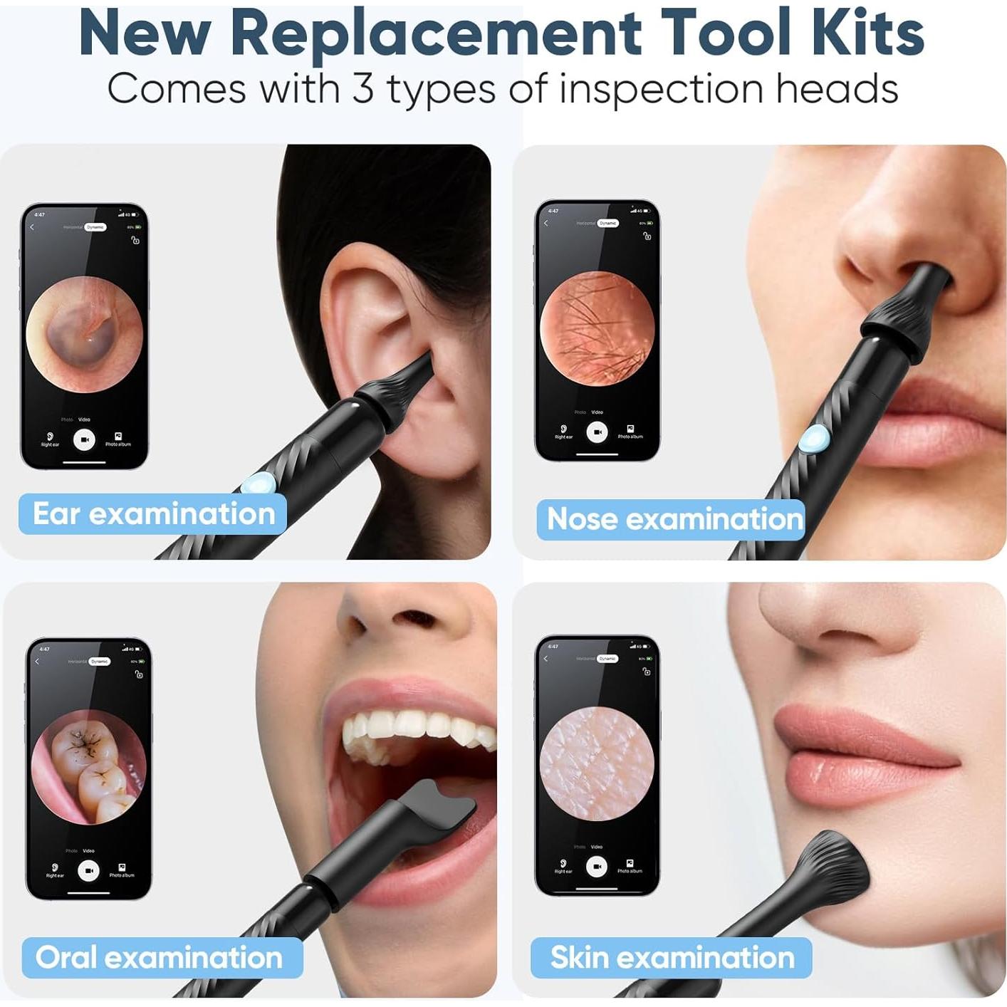 Limpiador de Oído Loyker X6 con Cámara 1080P LED Negro