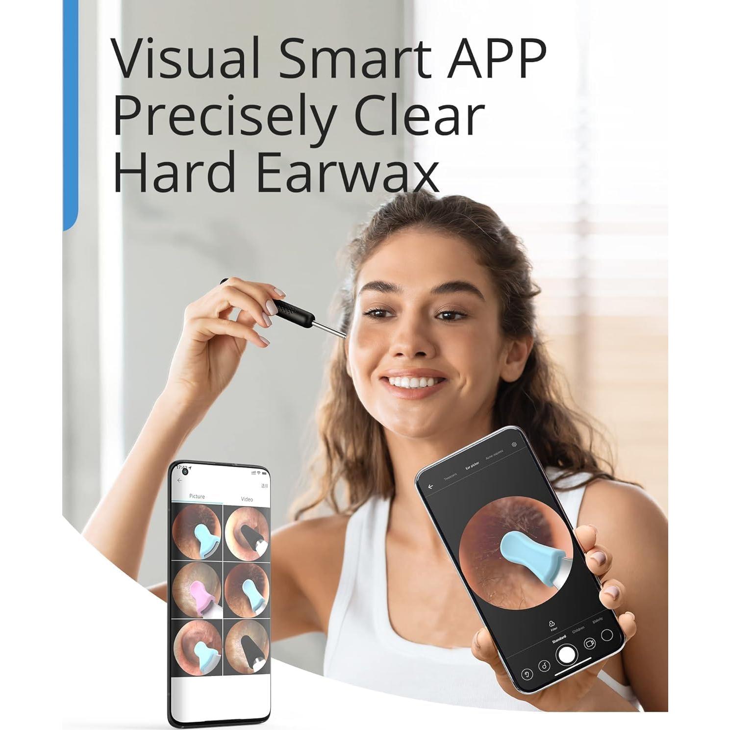 BEBIRD R1 Limpiador de Cerumen con Cámara HD y Luz LED