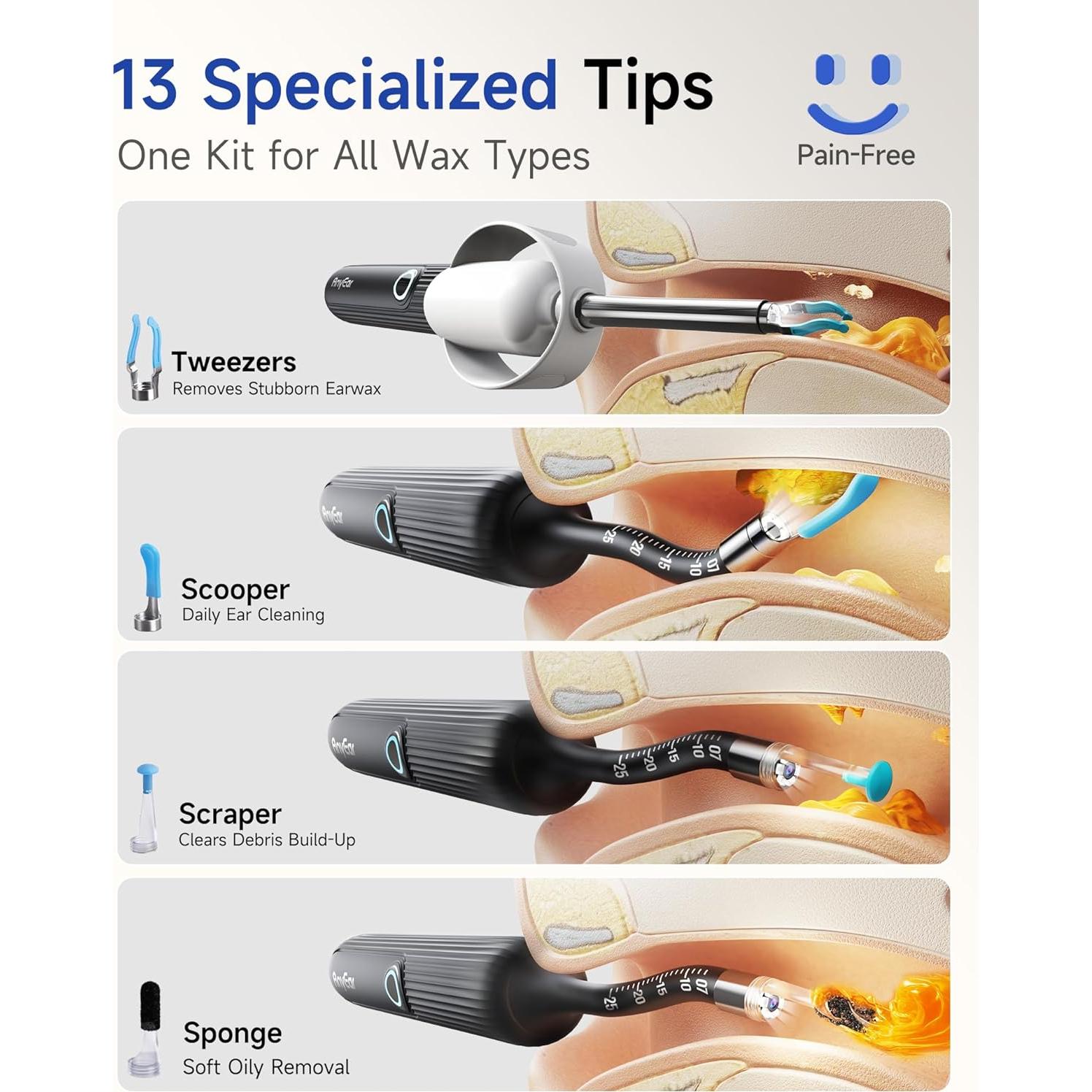 Limpiador de Oído Inalámbrico Anyear con Cámara 10MP HD