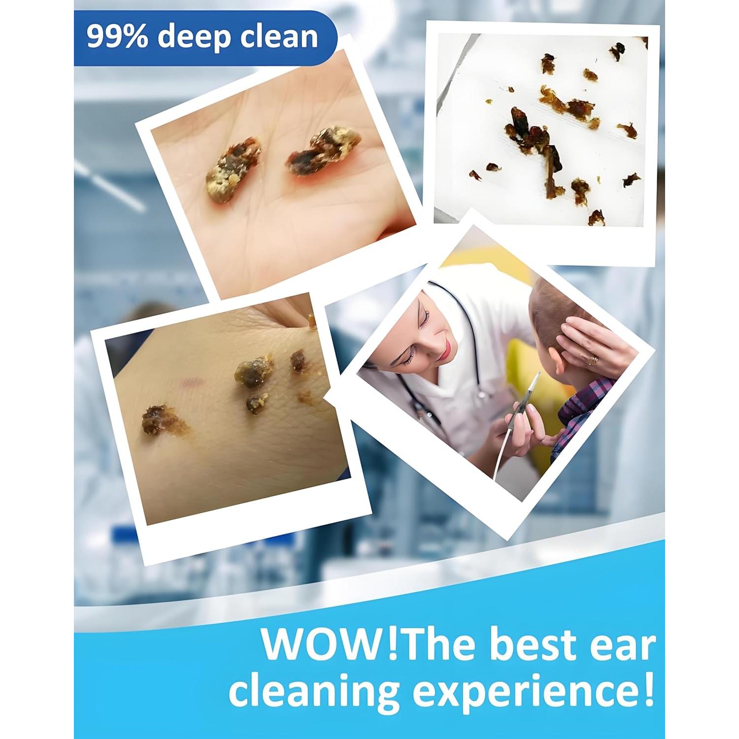 Kit Eliminación Cerumen KISSIMEE HE20 3 en 1 Recargable