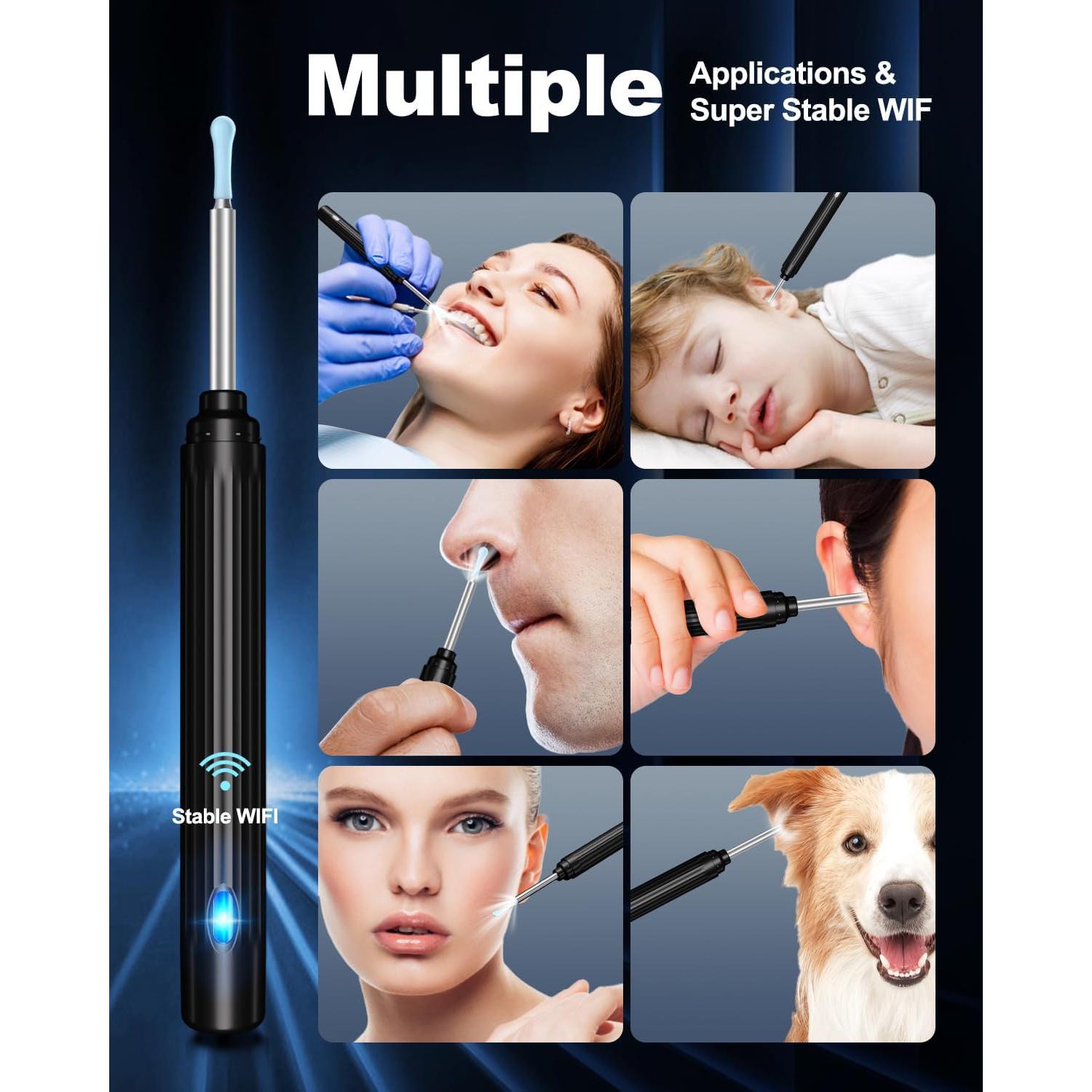 Kit de Limpieza de Oídos HaYiue 1296P HD con Cámara