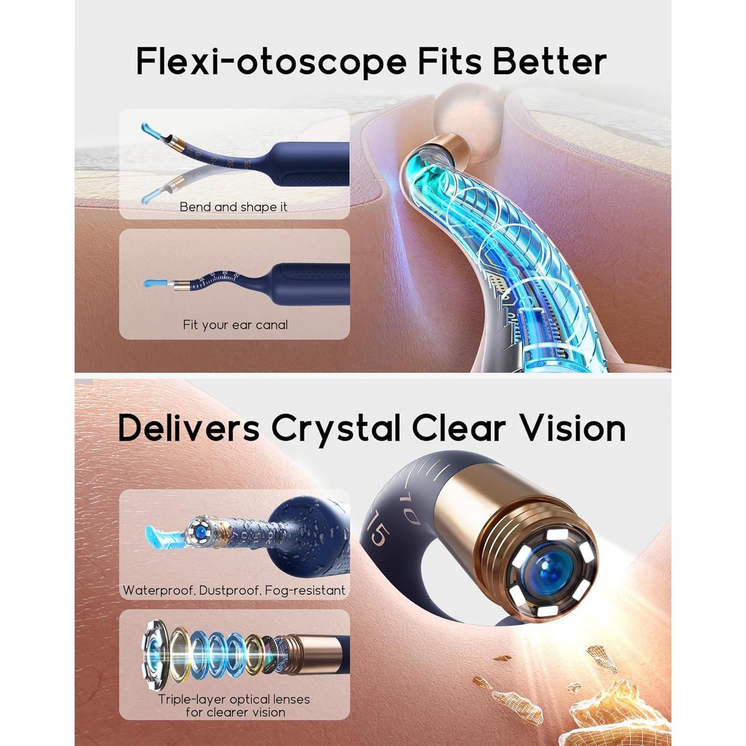 Bebird Earsight Plus Kit Limpieza Oídos Cámara HD 13,4 cm