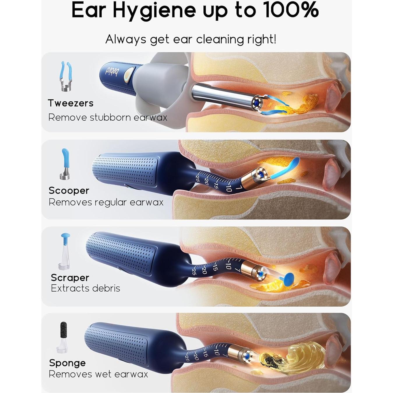 Bebird Earsight Plus Kit Limpieza Oídos Cámara HD 13,4 cm