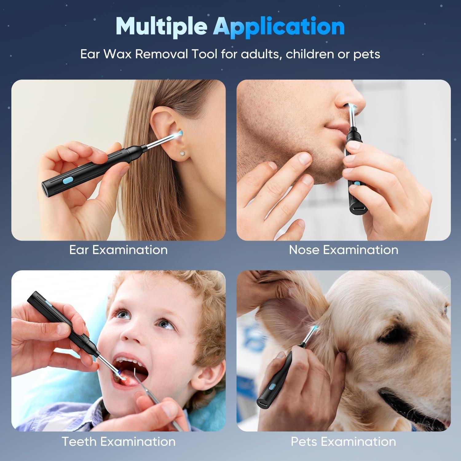 Kit de Eliminación de Cerumen MOOPHY con Cámara HD 1296P