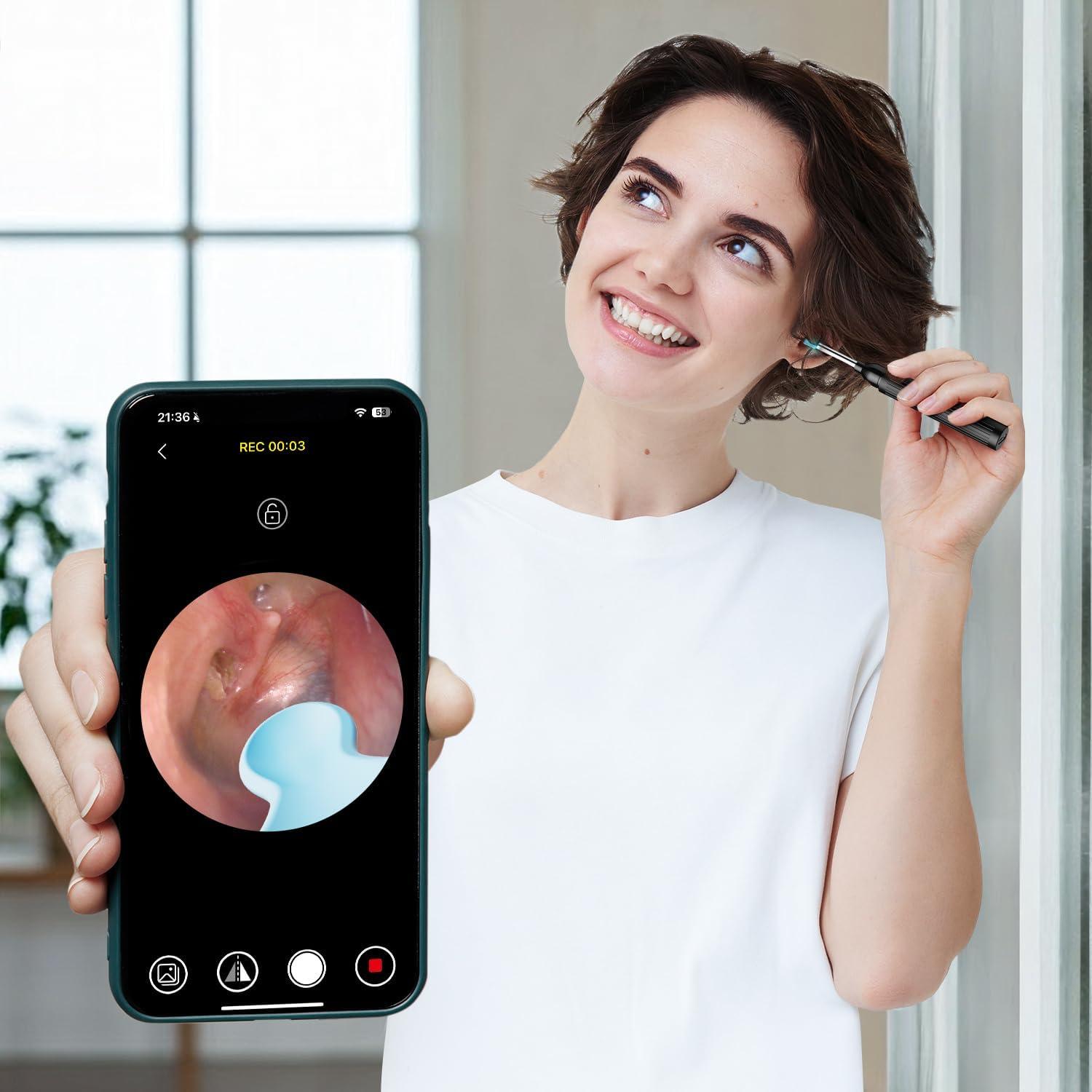 Kit de Eliminación de Cerumen MOOPHY con Cámara HD 1296P