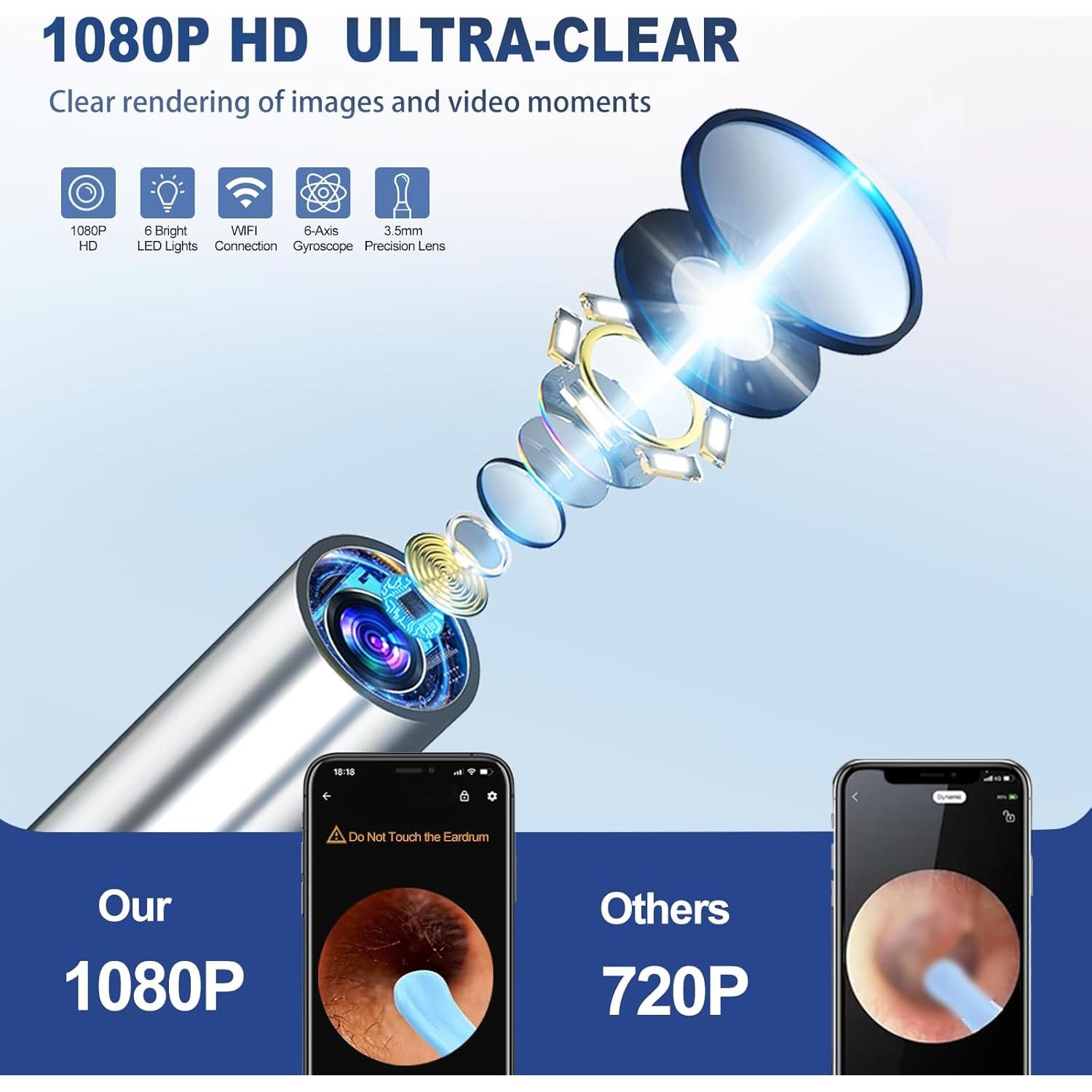 Limpiador de Oído NTGISO con Cámara 1080P y 6 LED