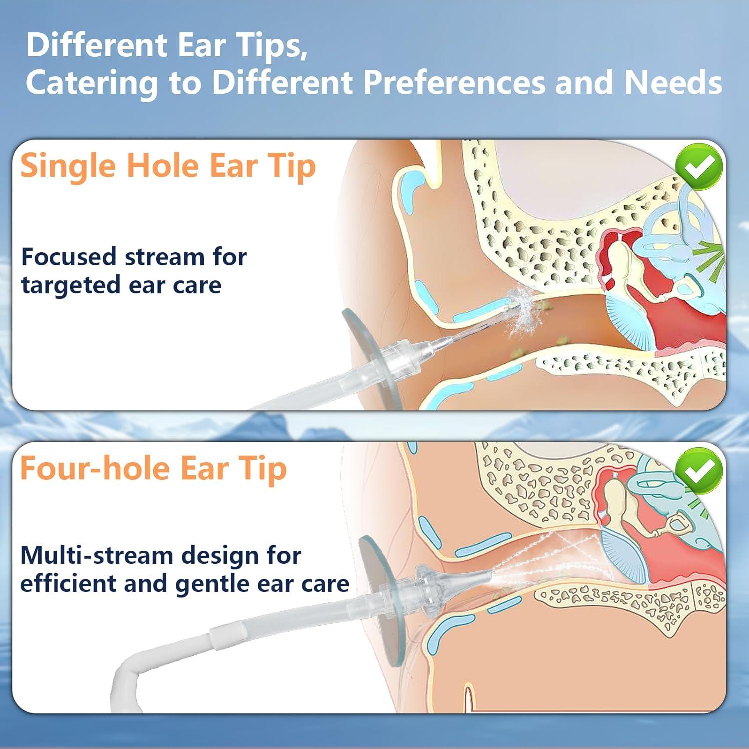 Kit de Limpieza de Oídos Lingtoud 26 Piezas Azul