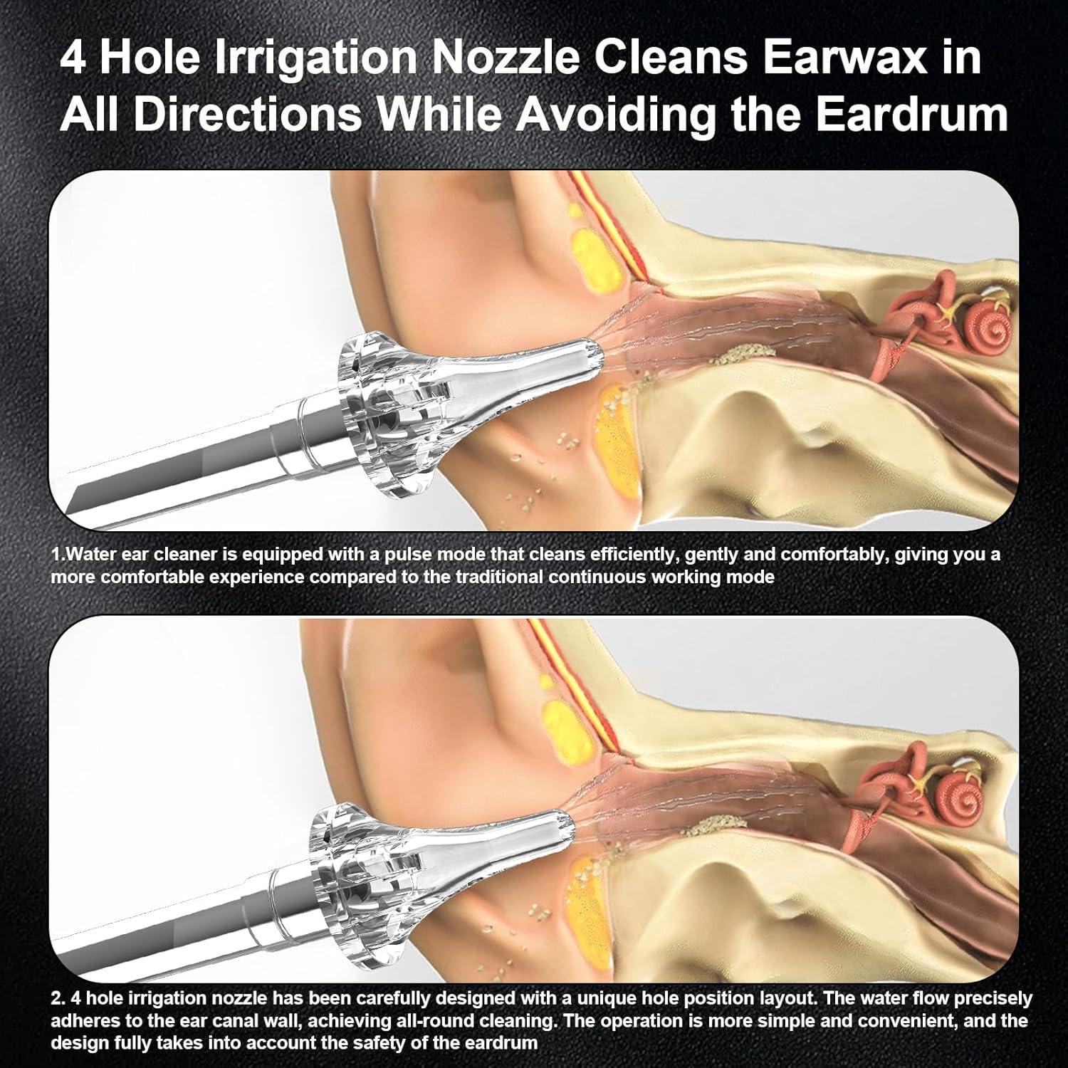 Limpiador de Oídos Eléctrico Lingtoud con Cámara HD 2 Pzs