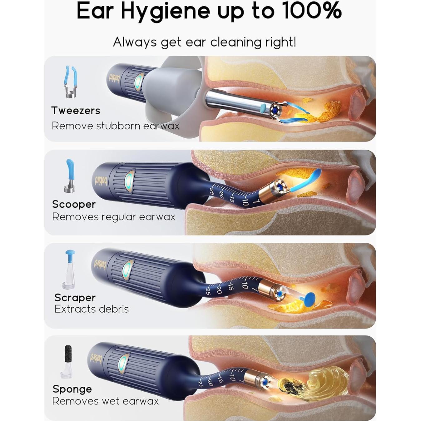 Kit de limpieza de oídos Earsight Plus con cámara HD