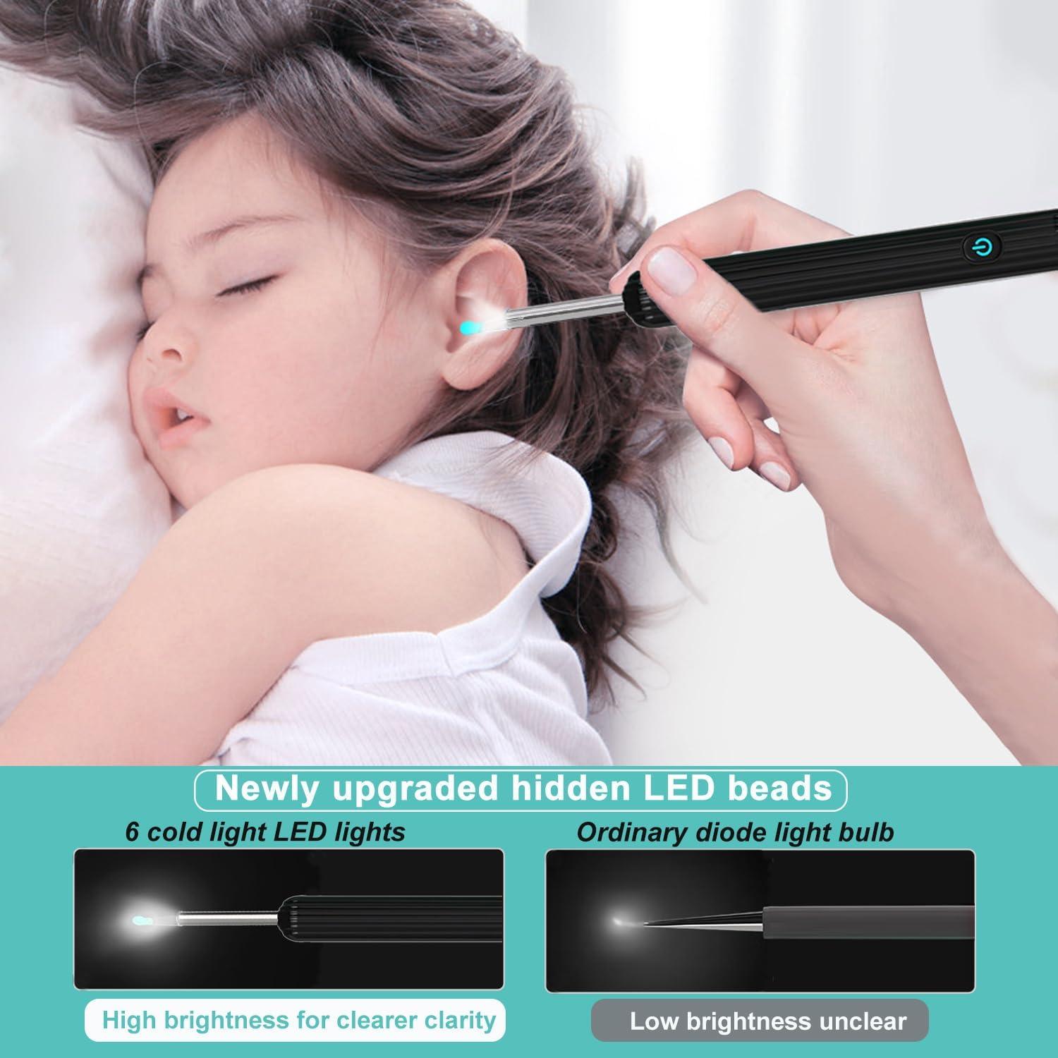 Kit de Eliminación de Cerumen OKUBOX con Cámara HD 1080P