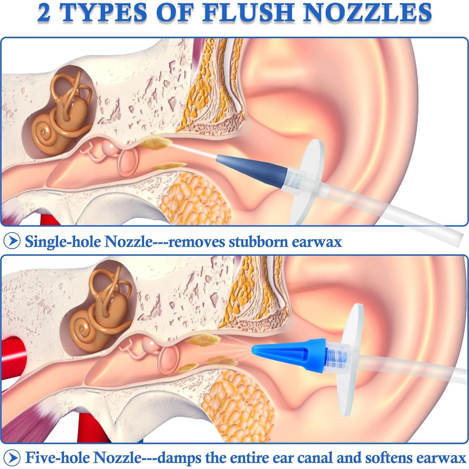 Kit de Limpieza de Oídos MOEBULB Irrigación Manual Seguro
