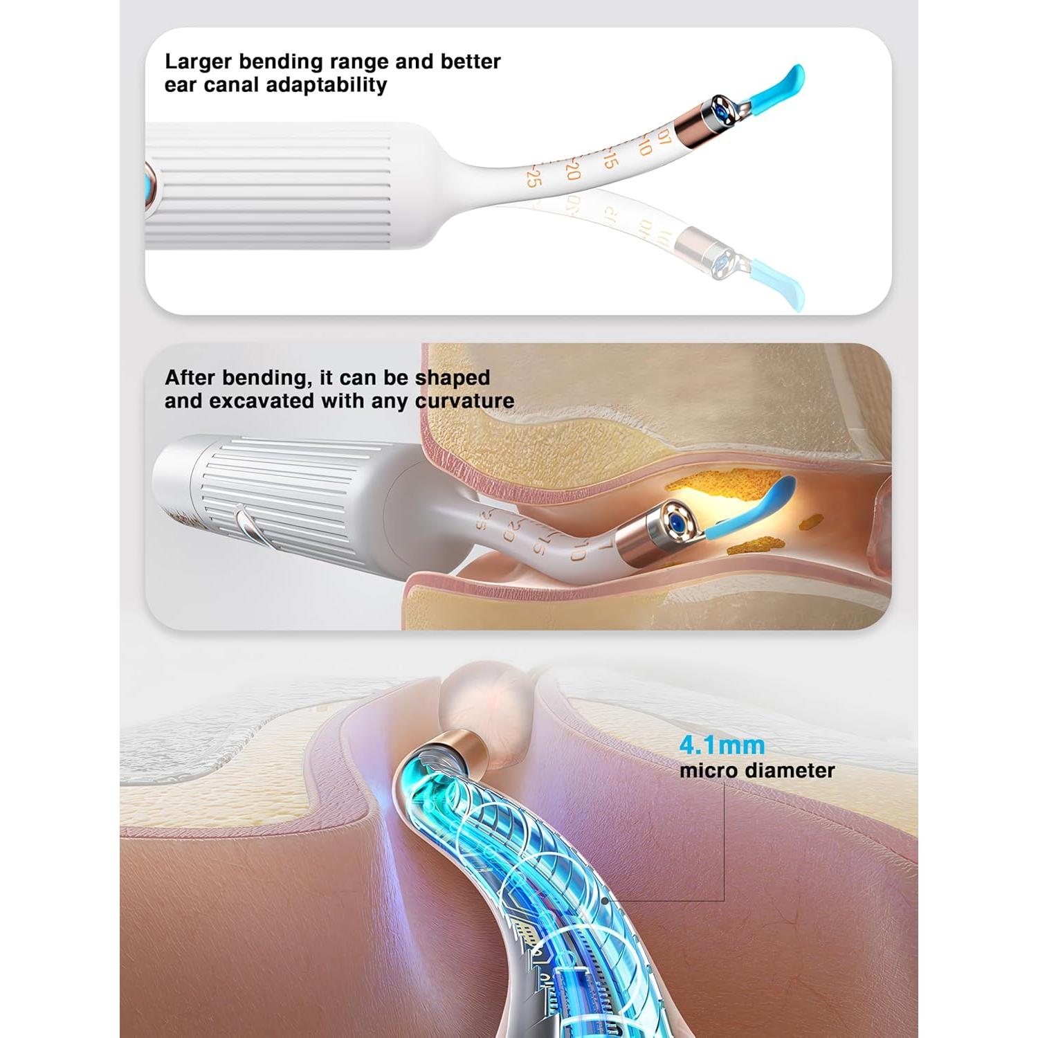 BEBIRD Earsight Plus Limpiador de Oídos HD WiFi Blanco