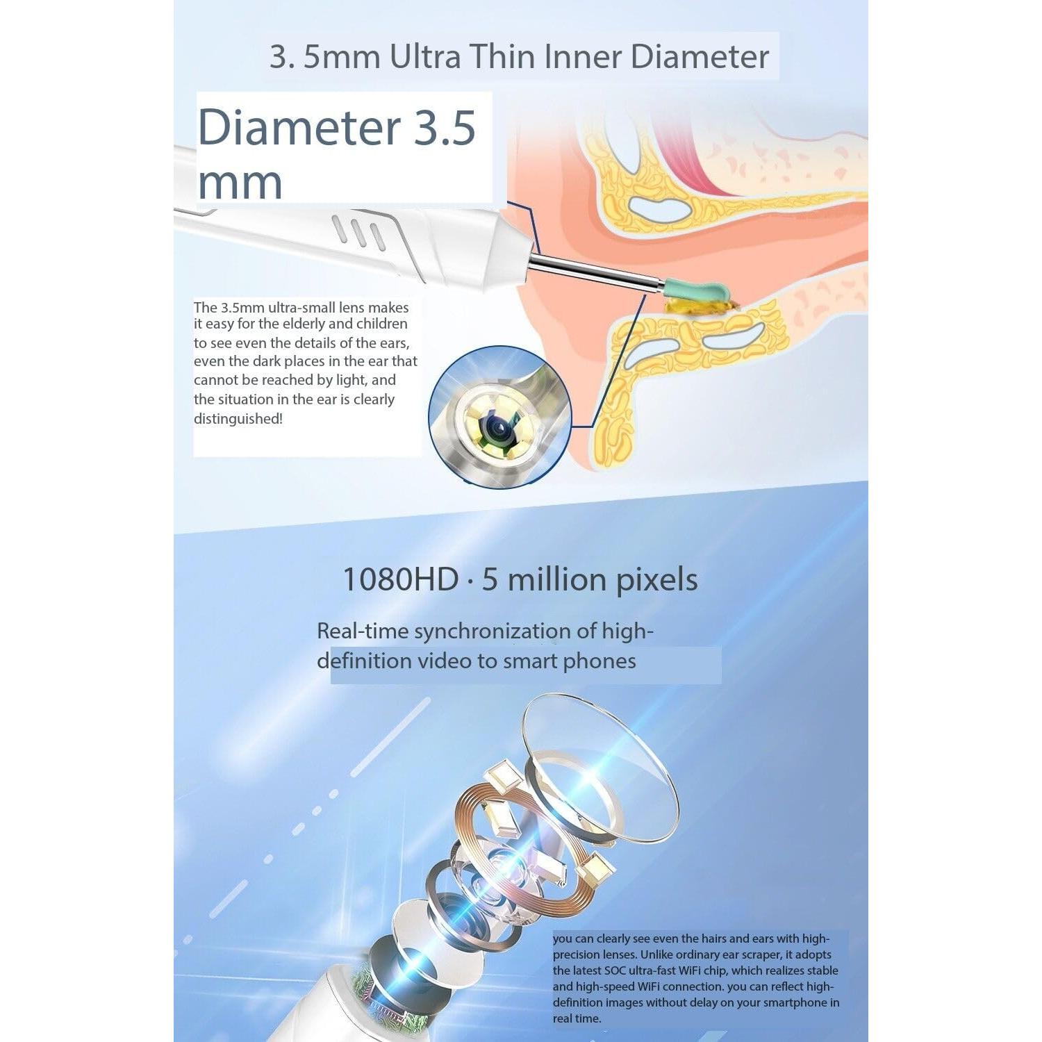 Endoscopio inalámbrico FHD 1080P Mahousky para oídos